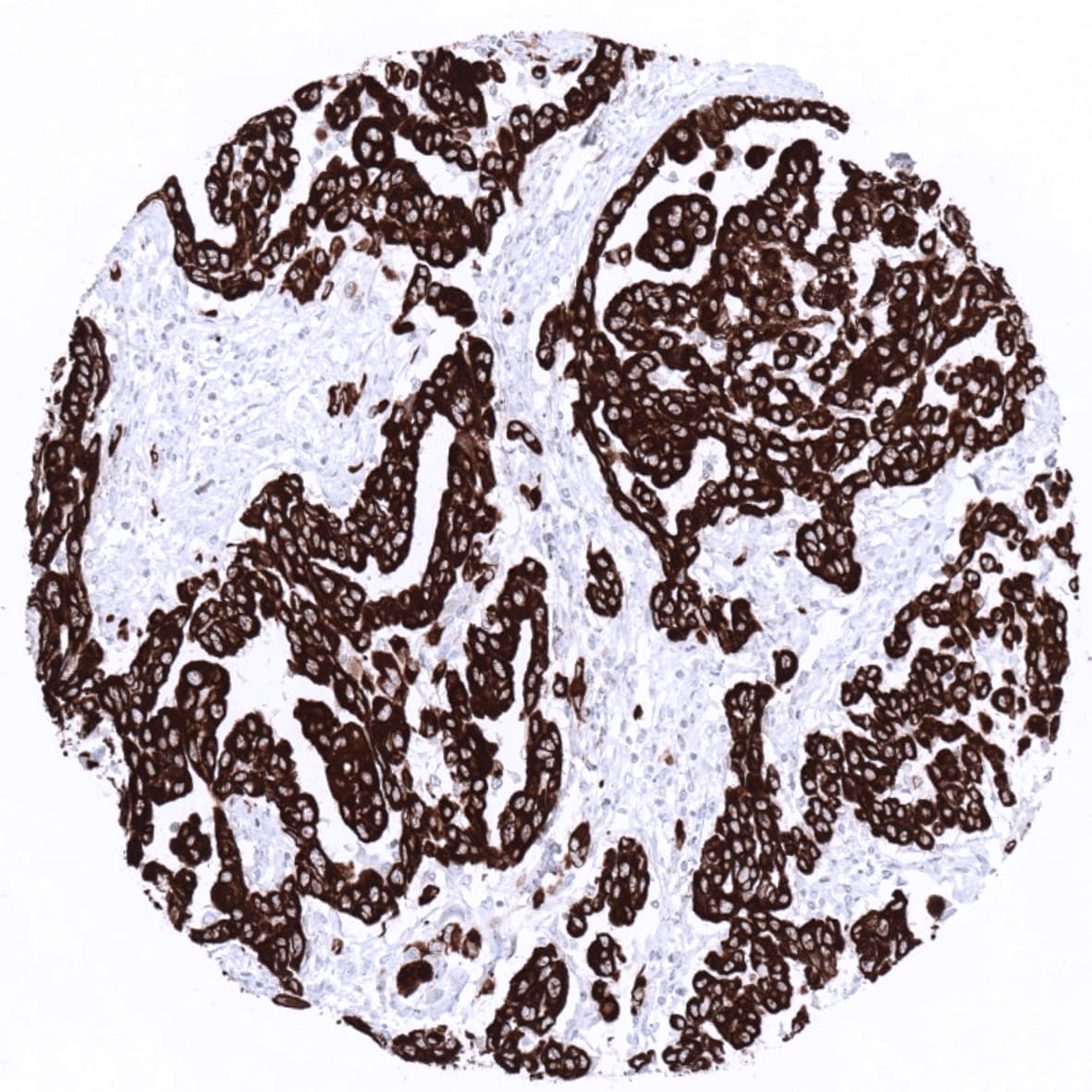 Cytokeratin 19 Antibody (MSVA-119M)