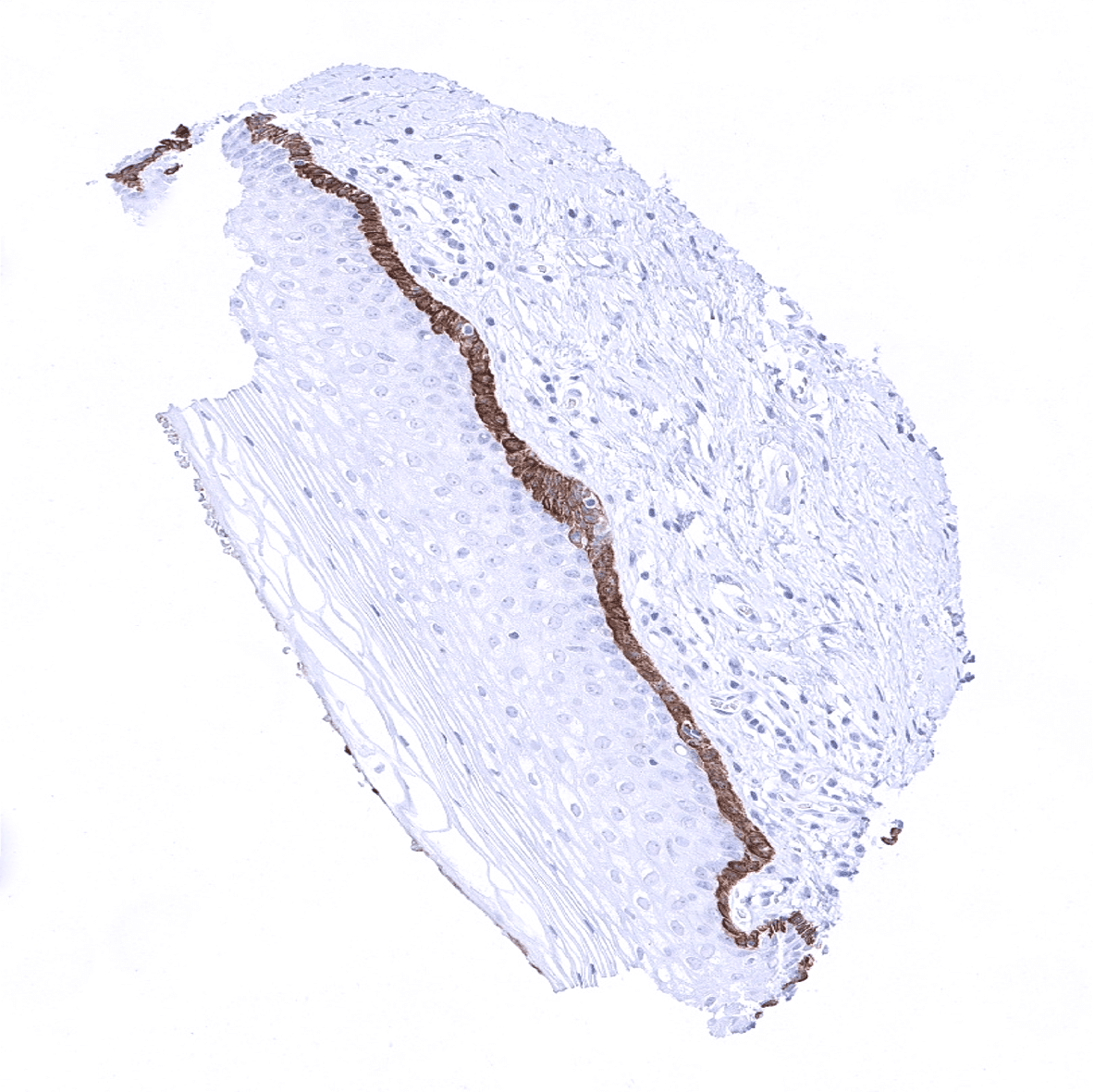 Cytokeratin 19 Antibody (MSVA-119M)
