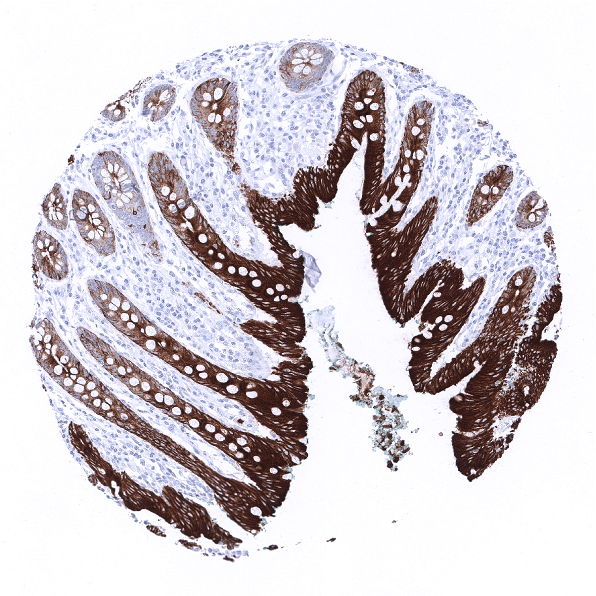 Cytokeratin 19 Antibody (MSVA-119M)