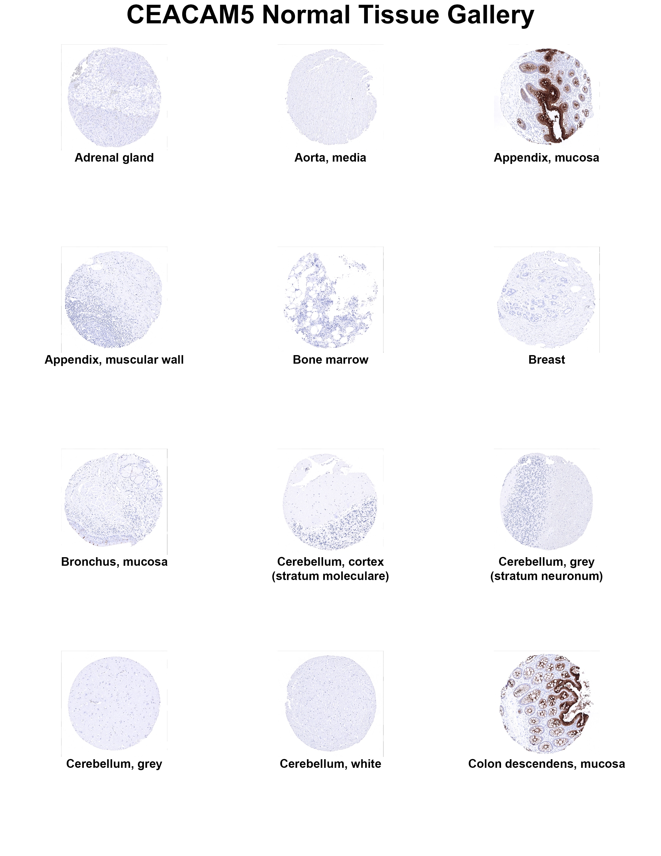 CEA Antibody (MSVA-465R) CEA Antibody (MSVA-465R) CEA Normal Tissue Gallery