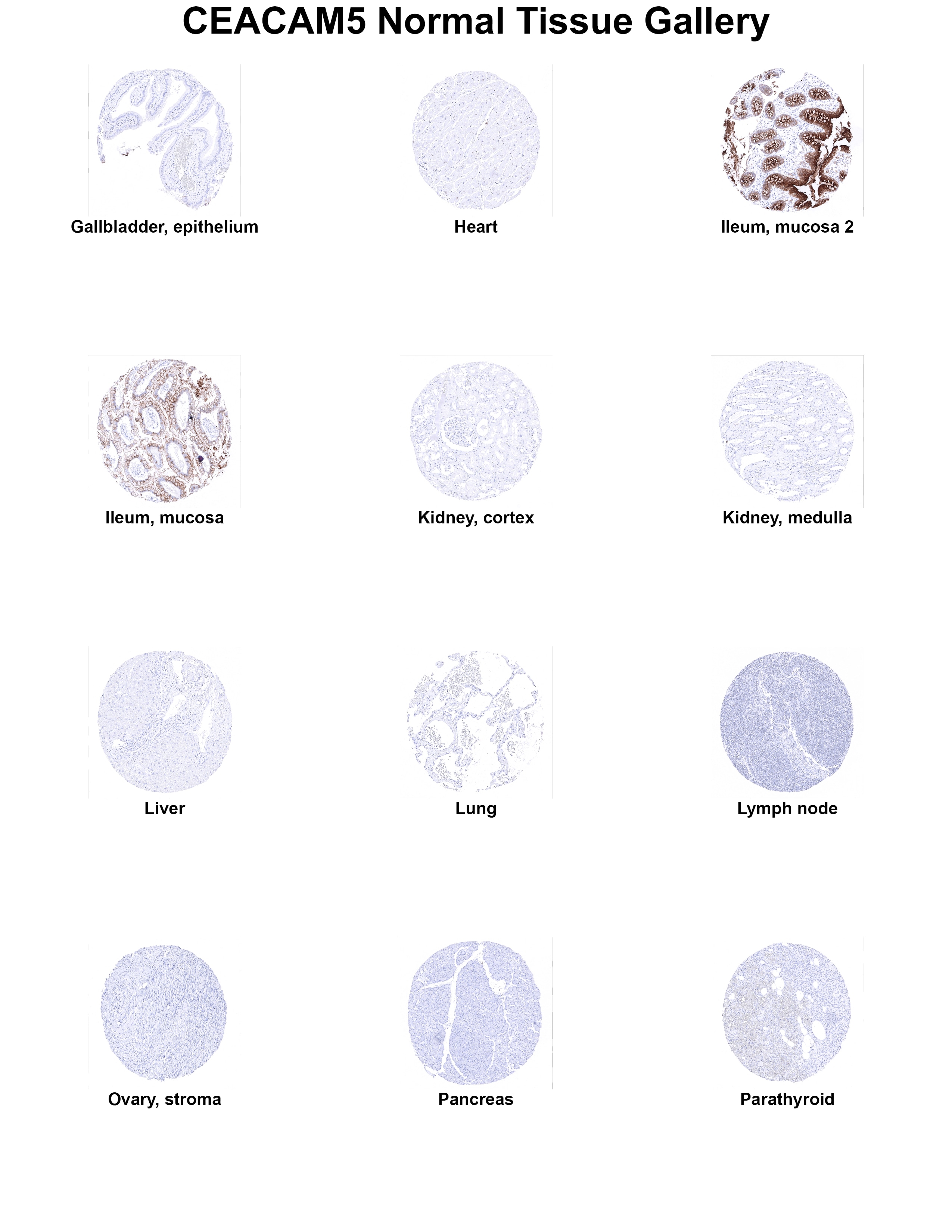 CEA Antibody (MSVA-465R) CEA Antibody (MSVA-465R) CEA Normal Tissue Gallery