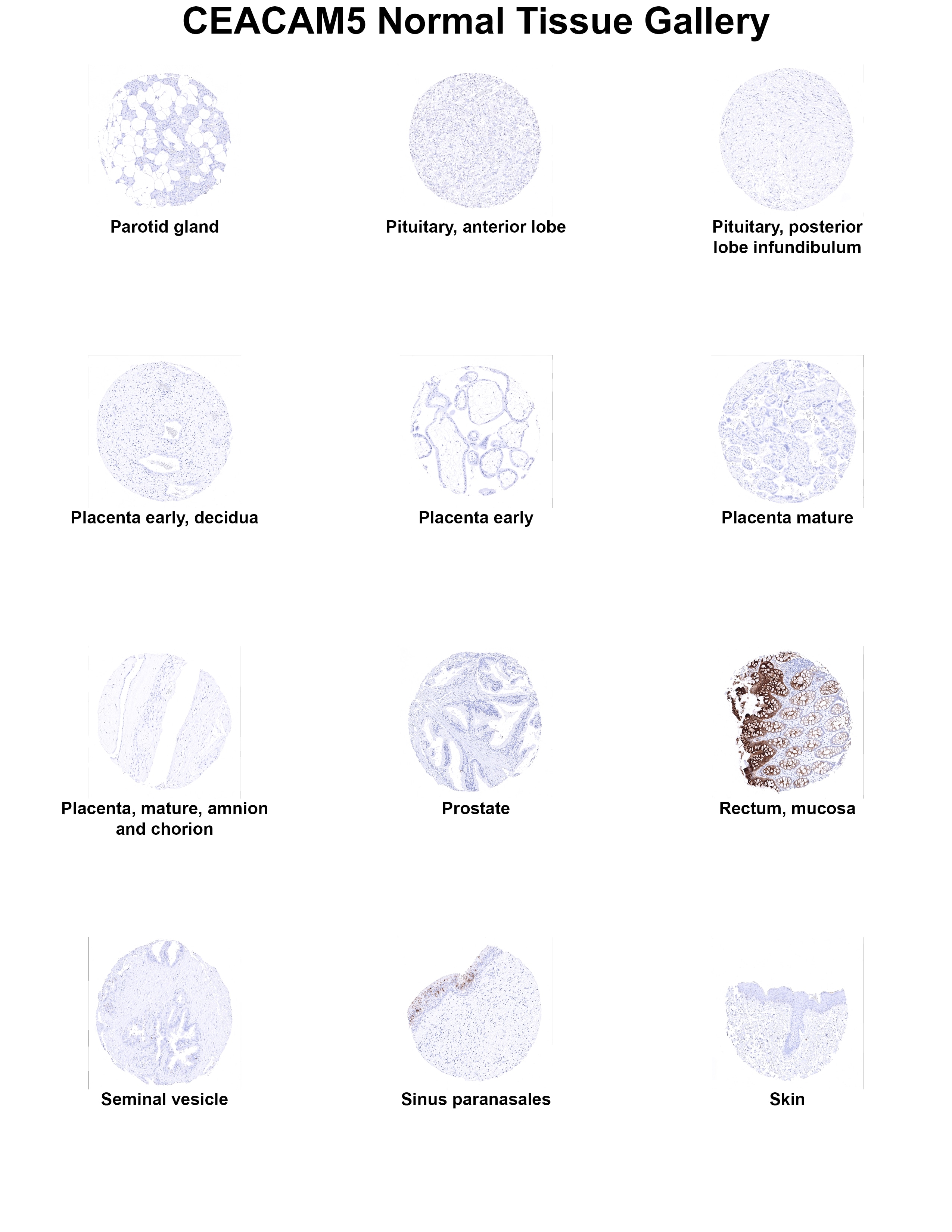CEA Antibody (MSVA-465R) CEA Antibody (MSVA-465R) CEA Normal Tissue Gallery