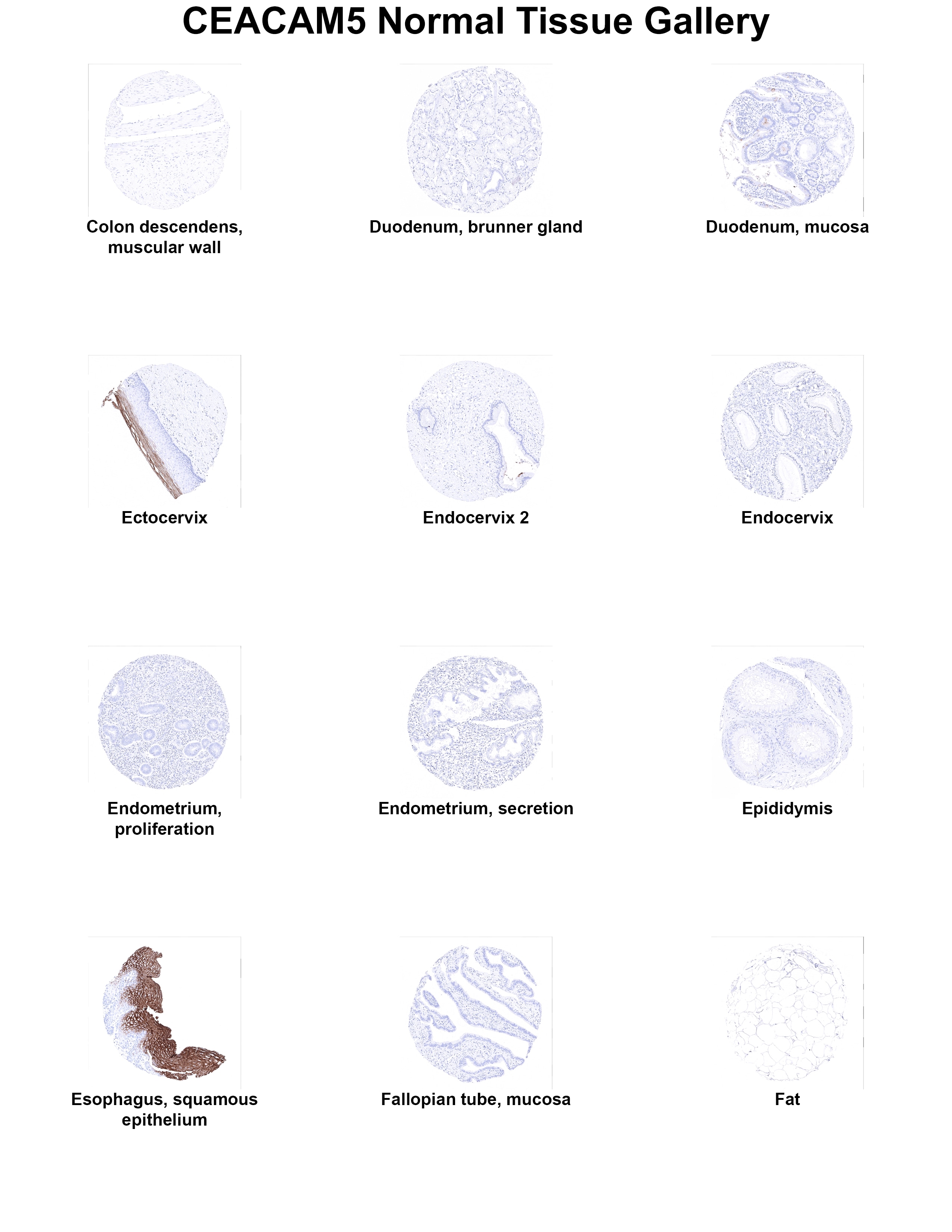 CEA Antibody (MSVA-465R) CEA Antibody (MSVA-465R) CEA Normal Tissue Gallery