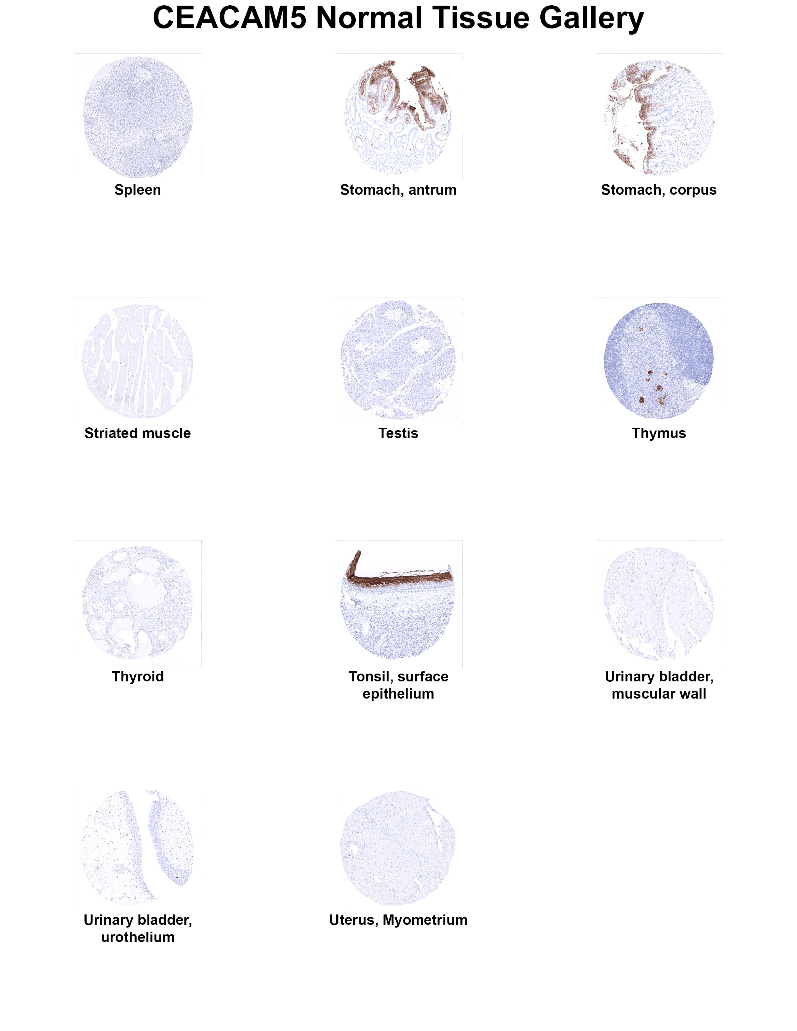 CEA Antibody (MSVA-465R) CEA Antibody (MSVA-465R) CEA Normal Tissue Gallery