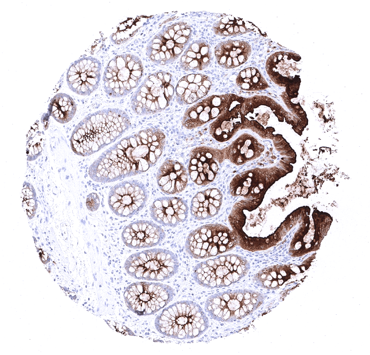 CEA Antibody (MSVA-465R)