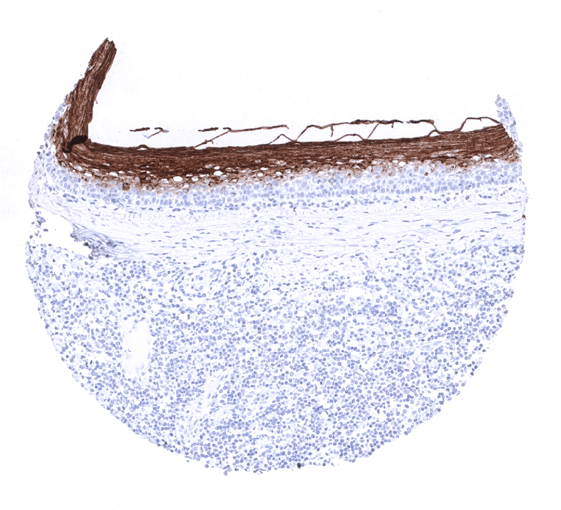CEA Antibody (MSVA-465R)
