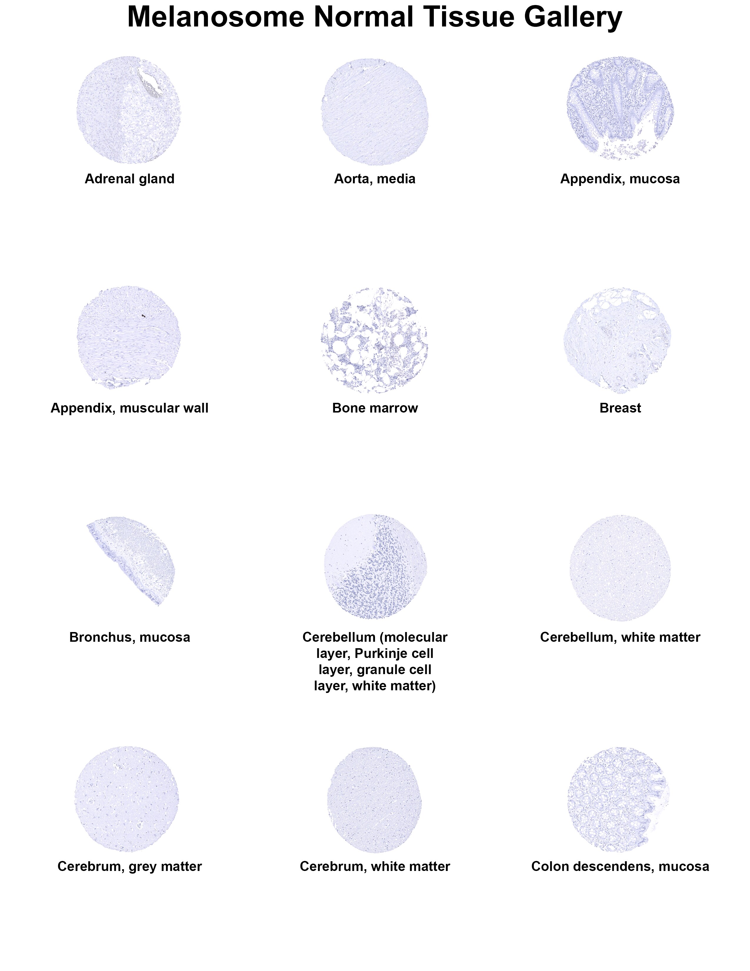 PMEL17/SILV Antibody (MSVA-617R) PMEL17/SILV Antibody (MSVA-617R) PMEL17/SILV Normal Tissue Gallery