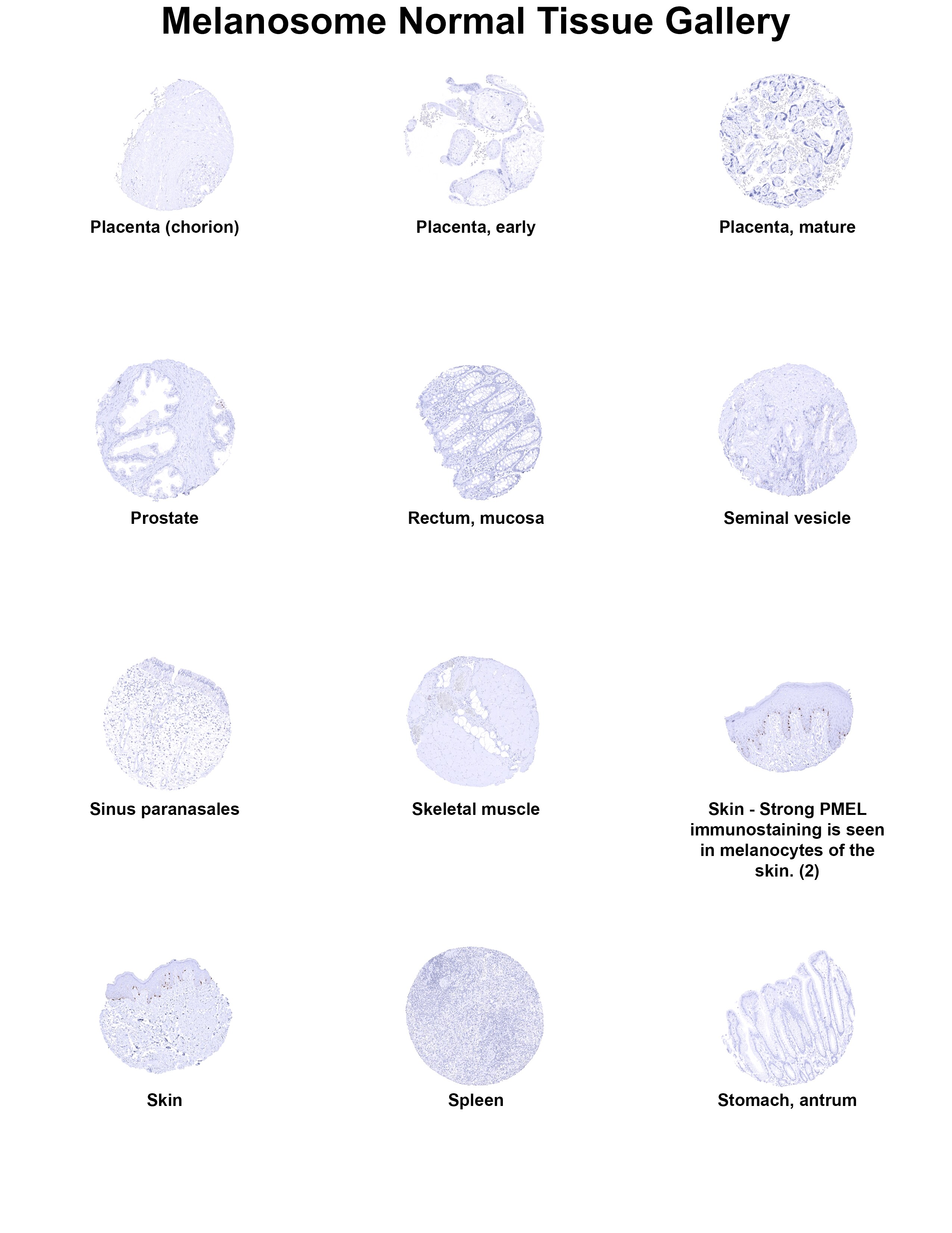 PMEL17/SILV Antibody (MSVA-617R) PMEL17/SILV Antibody (MSVA-617R) PMEL17/SILV Normal Tissue Gallery