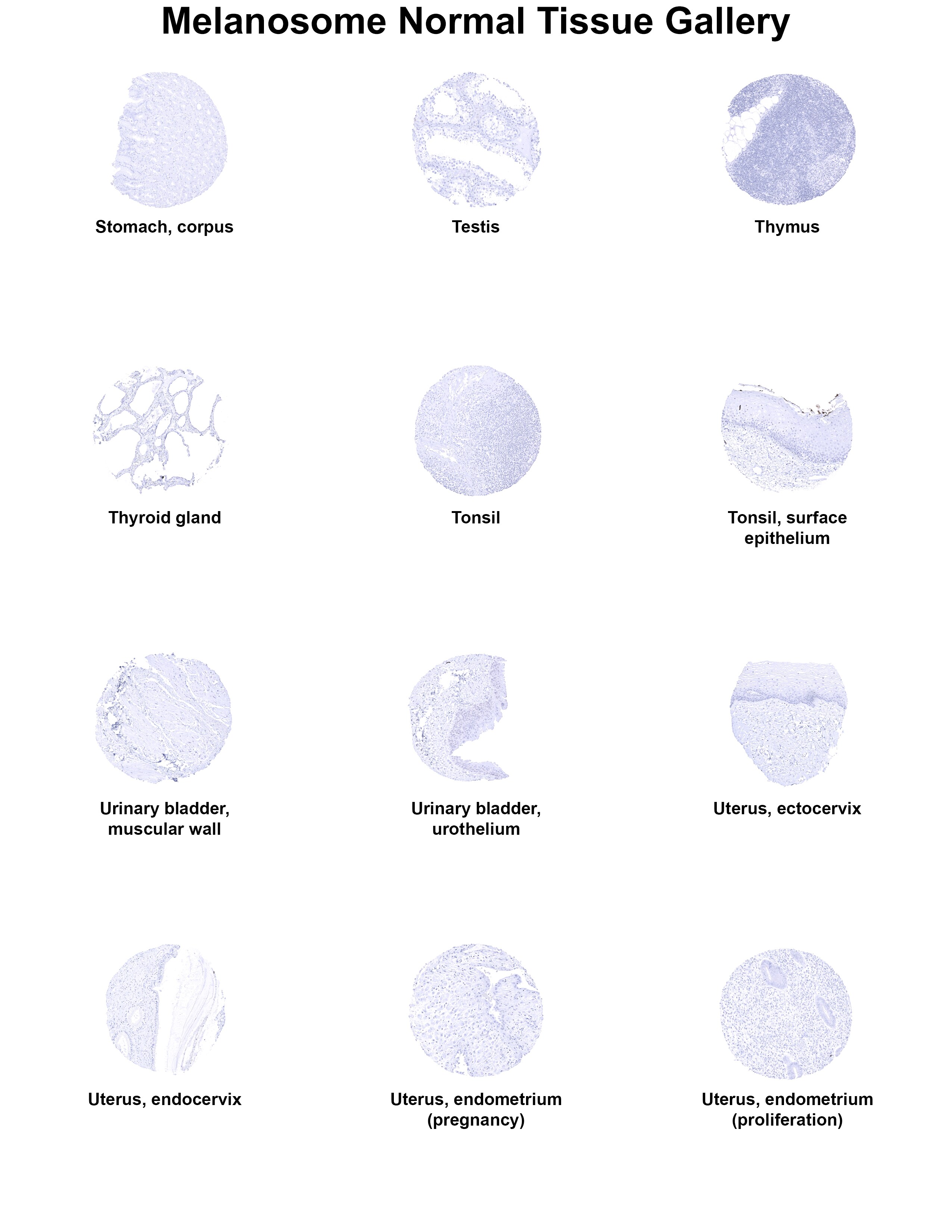 PMEL17/SILV Antibody (MSVA-617R) PMEL17/SILV Antibody (MSVA-617R) PMEL17/SILV Normal Tissue Gallery