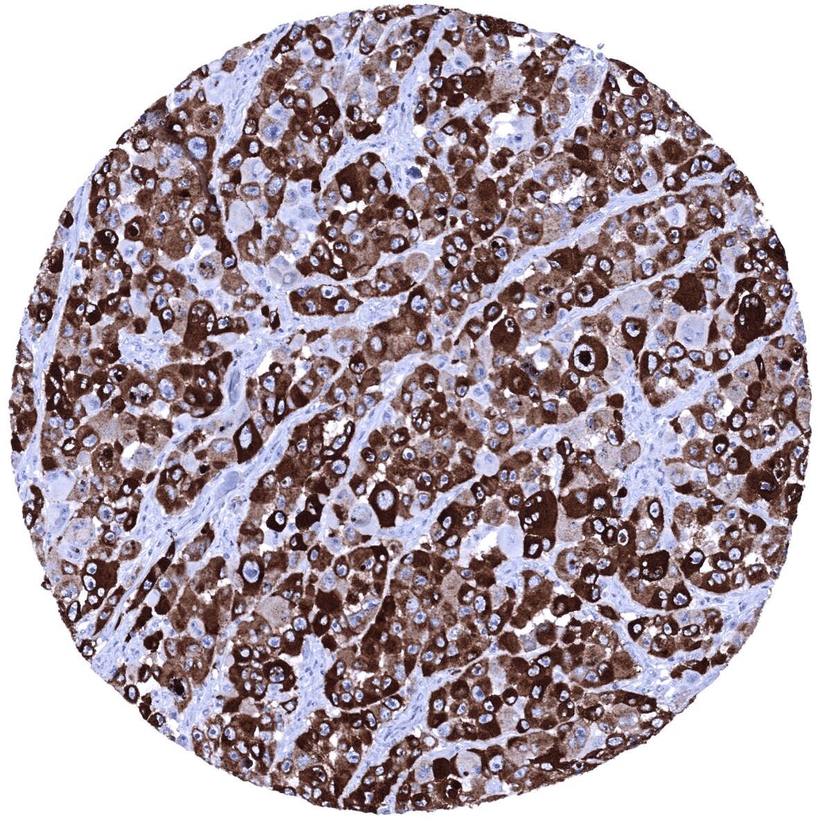 PMEL17/SILV Antibody (MSVA-617R)