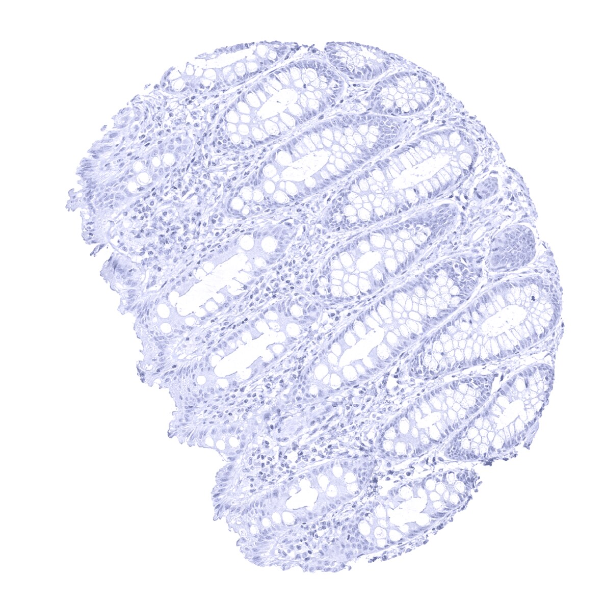 PMEL17/SILV Antibody (MSVA-617R)