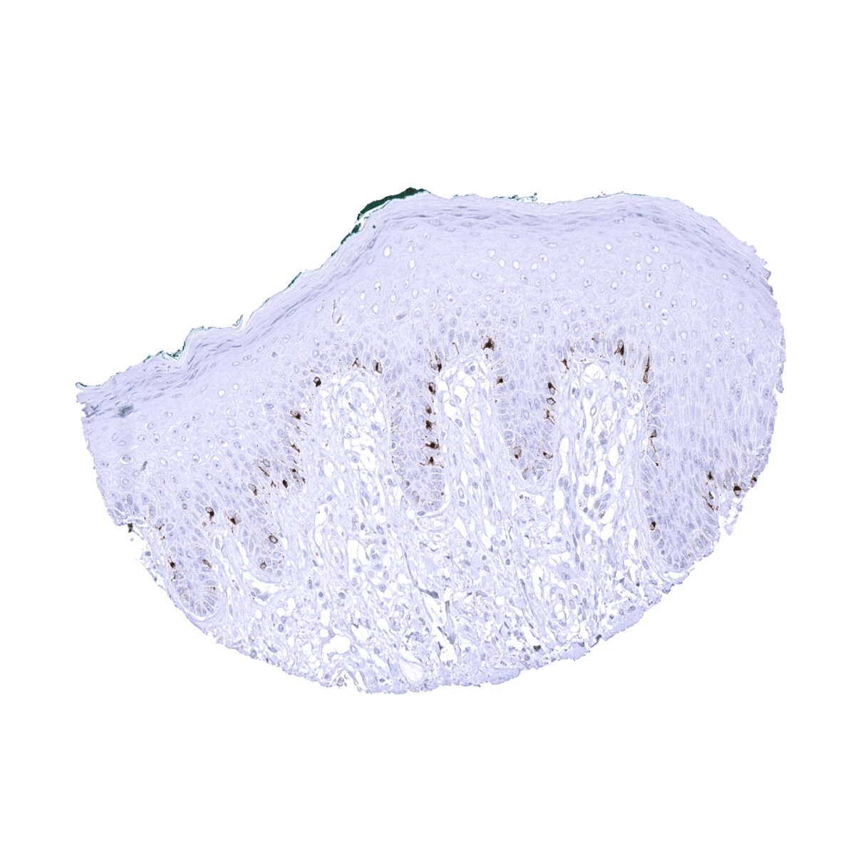 PMEL17/SILV Antibody (MSVA-617R)