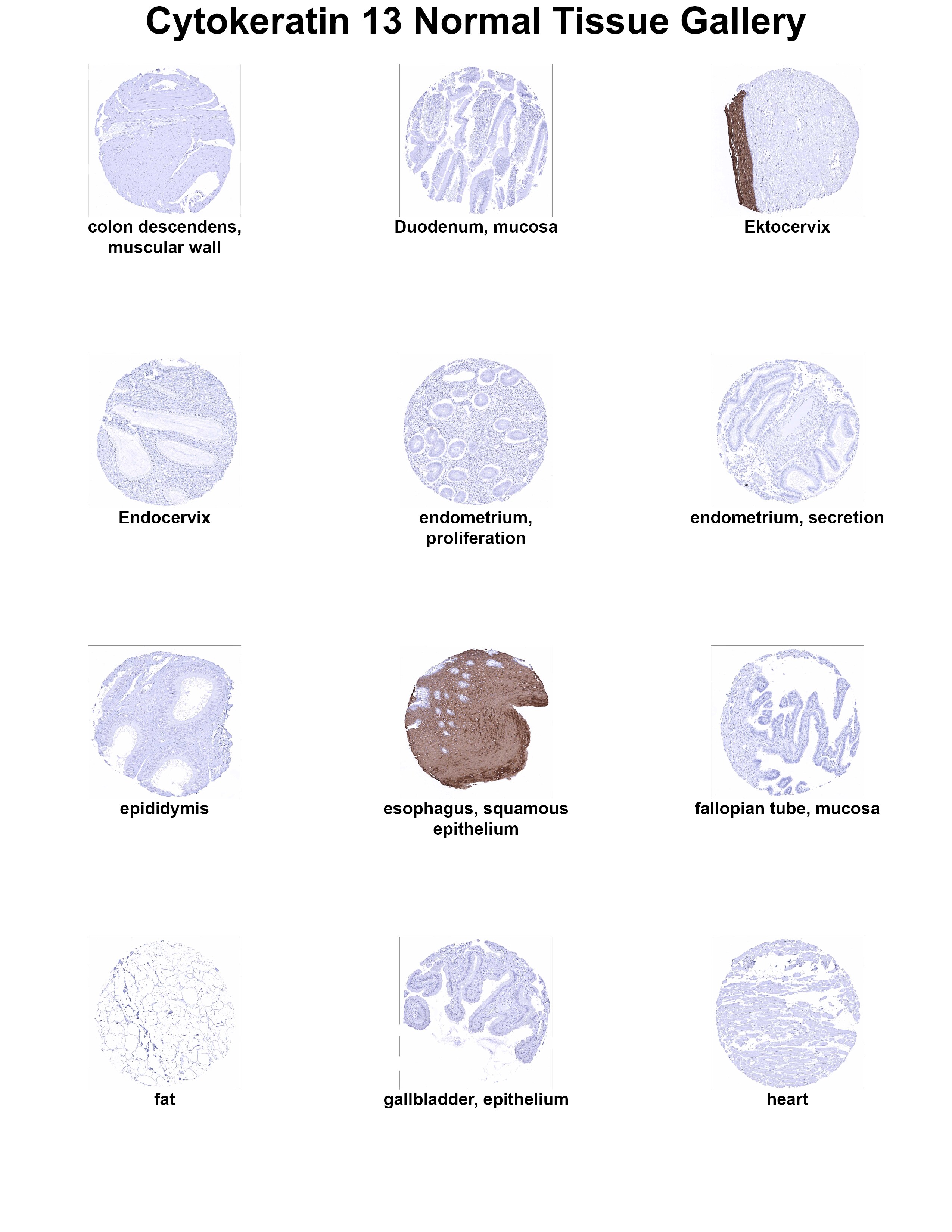 Cytokeratin 13 Antibody (MSVA-613M) Cytokeratin 13 Antibody (MSVA-613M) Cytokeratin 13 Normal Tissue Gallery
