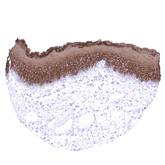 Cytokeratin 13 Antibody (MSVA-613M)
