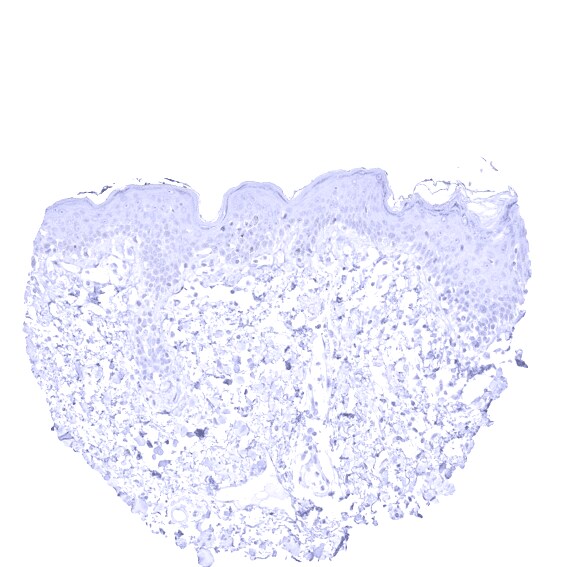 Cytokeratin 13 Antibody (MSVA-613M)