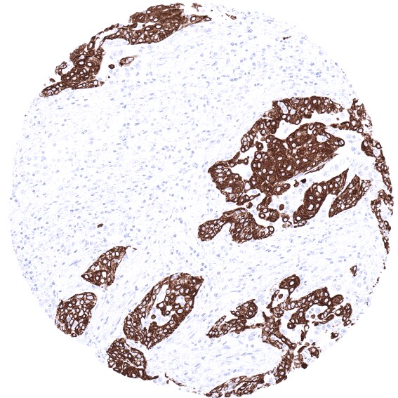 Cytokeratin 13 Antibody (MSVA-613M)