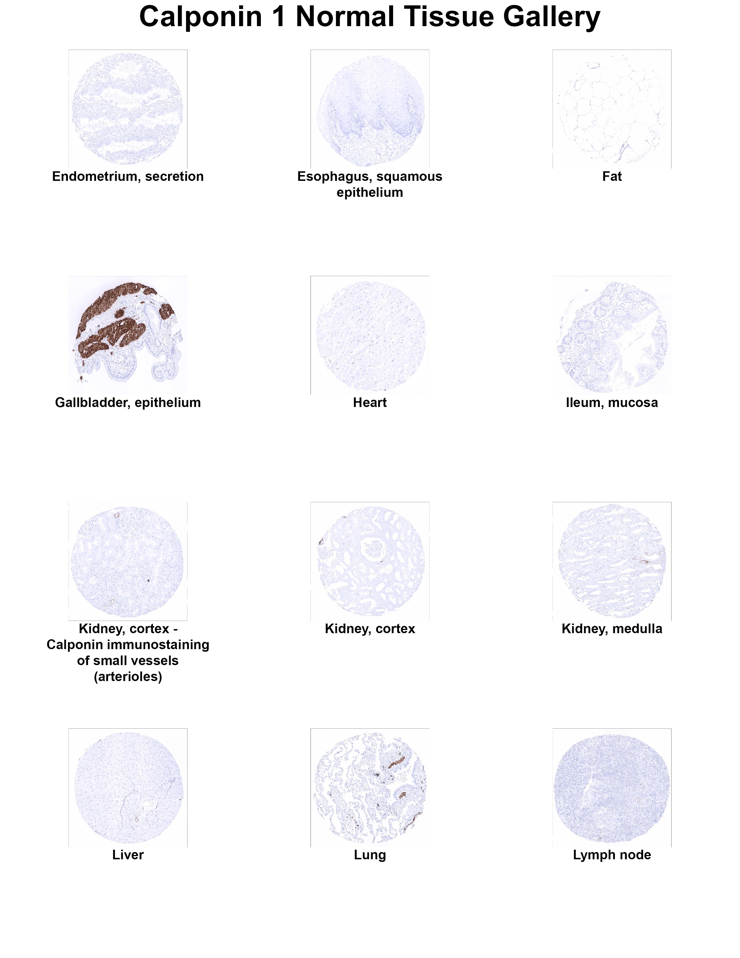 Calponin 1 Antibody (MSVA-455R) Calponin 1 Antibody (MSVA-455R) Calponin 1 Normal Tissue Gallery