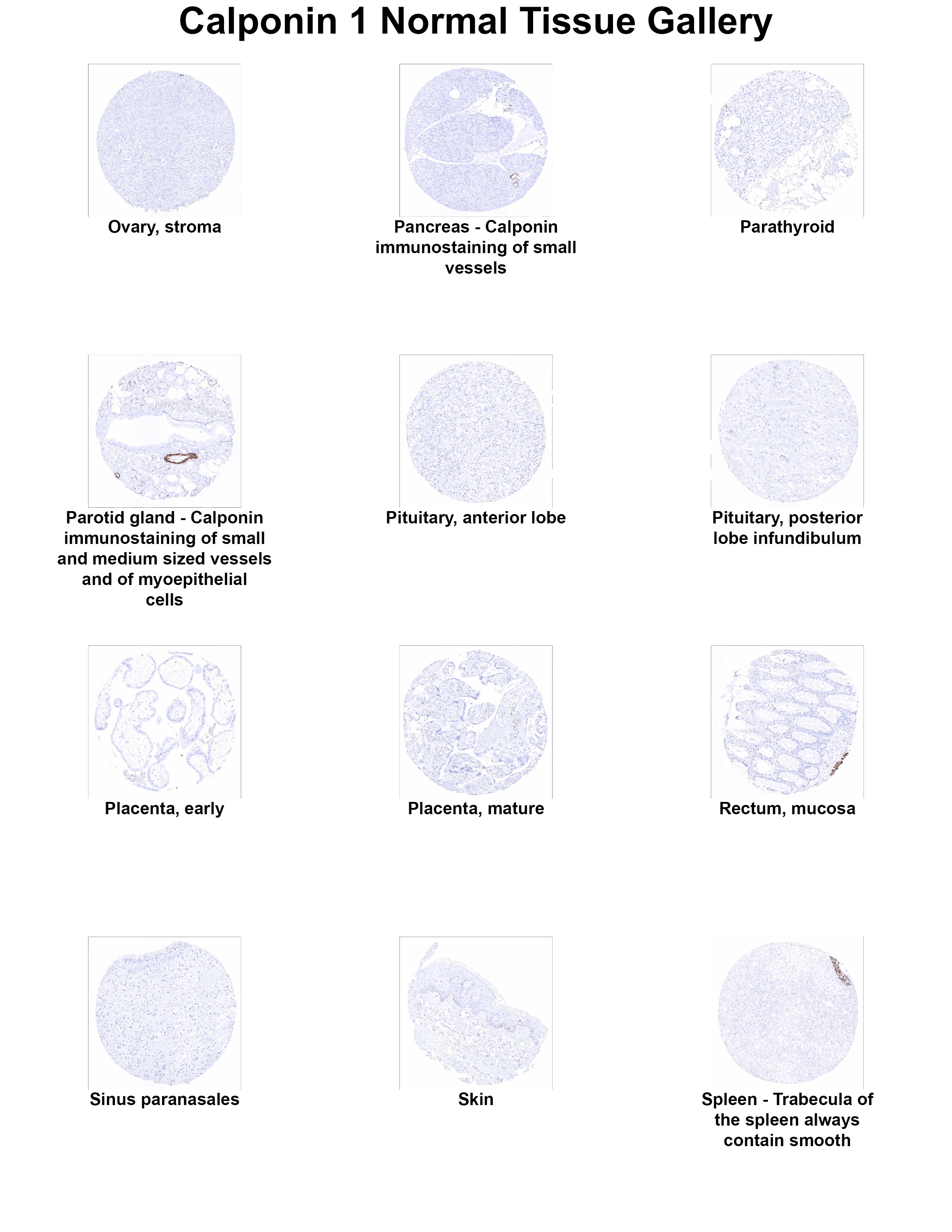 Calponin 1 Antibody (MSVA-455R) Calponin 1 Antibody (MSVA-455R) Calponin 1 Normal Tissue Gallery