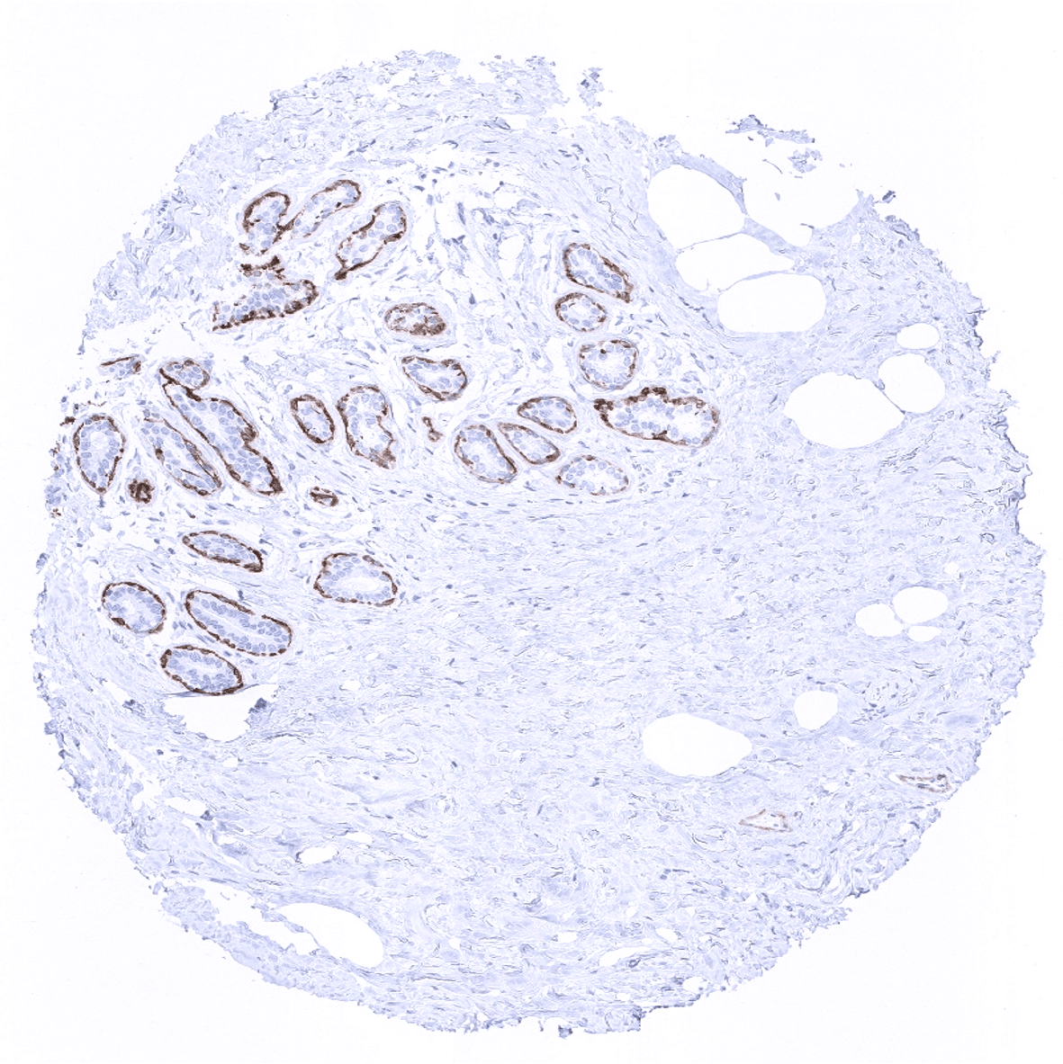 Calponin 1 Antibody (MSVA-455R)