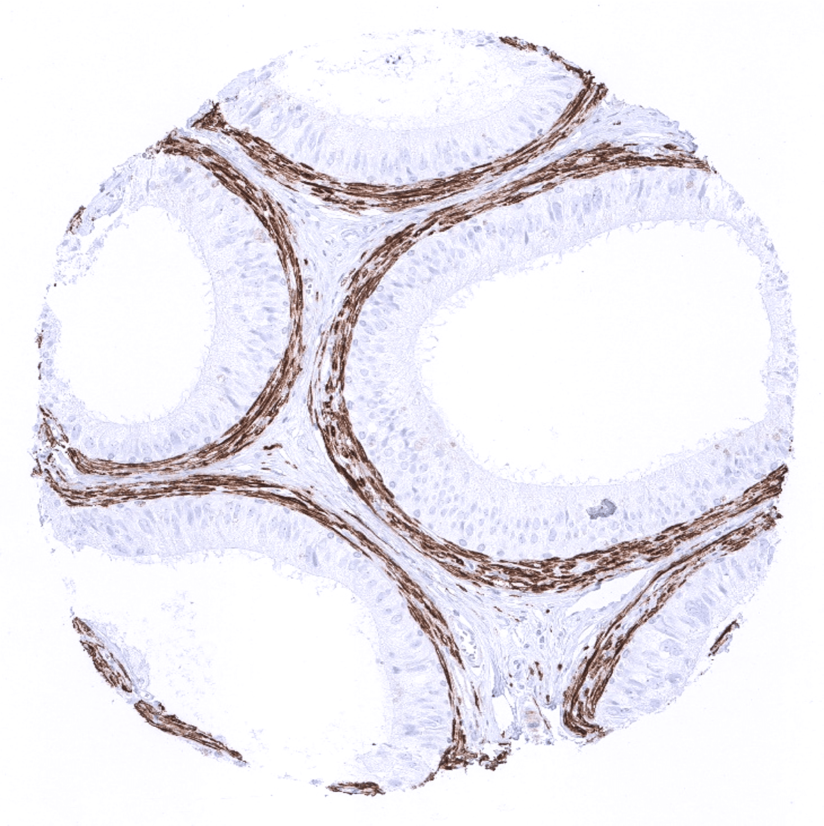 Calponin 1 Antibody (MSVA-455R)