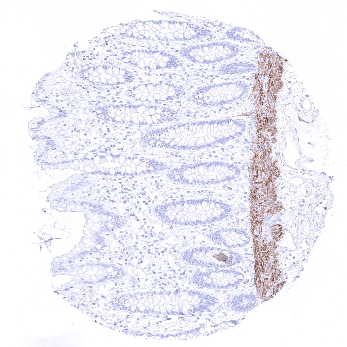 Calponin 1 Antibody (MSVA-455R)