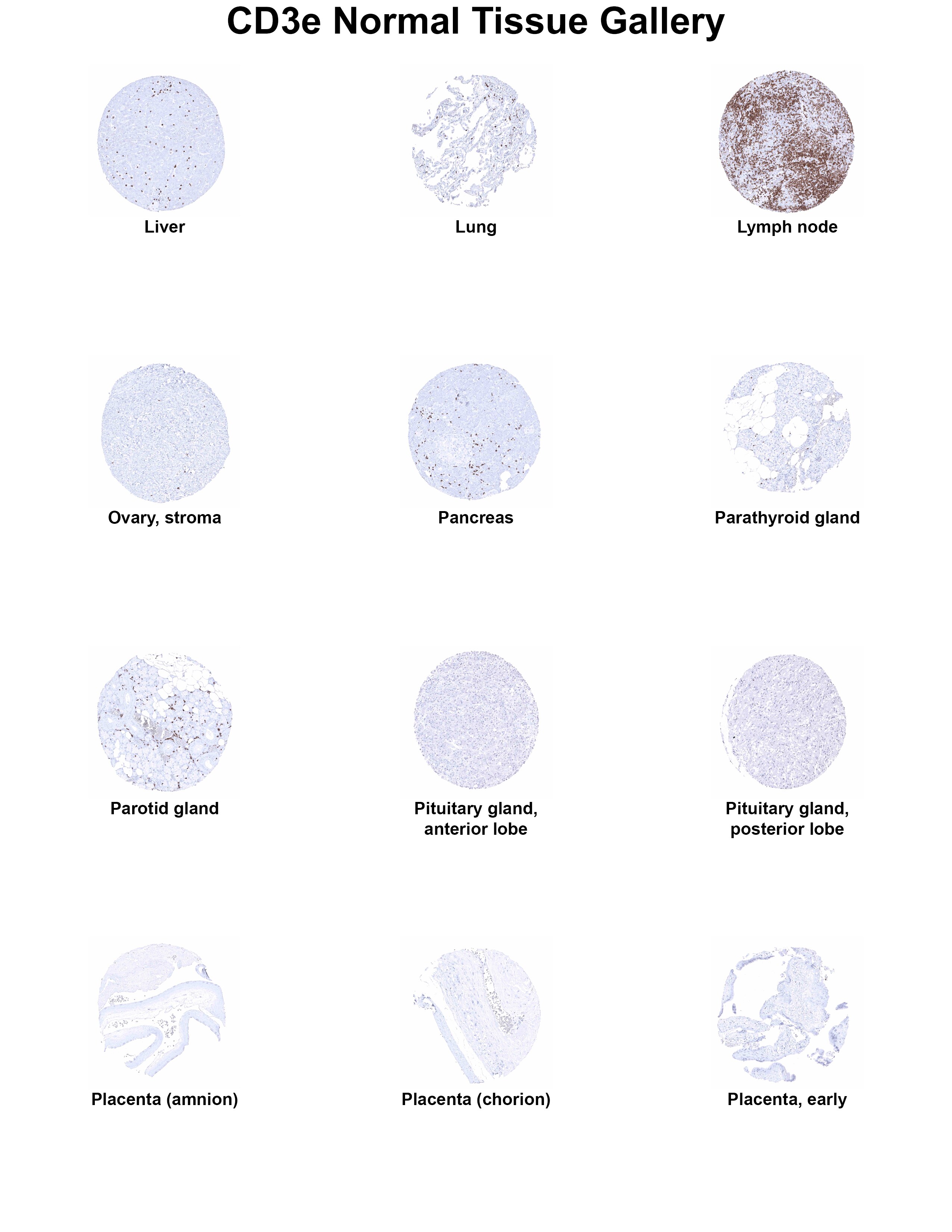 CD3 Antibody (MSVA-003R) CD3 Antibody (MSVA-003R) CD3 Normal Tissue Gallery