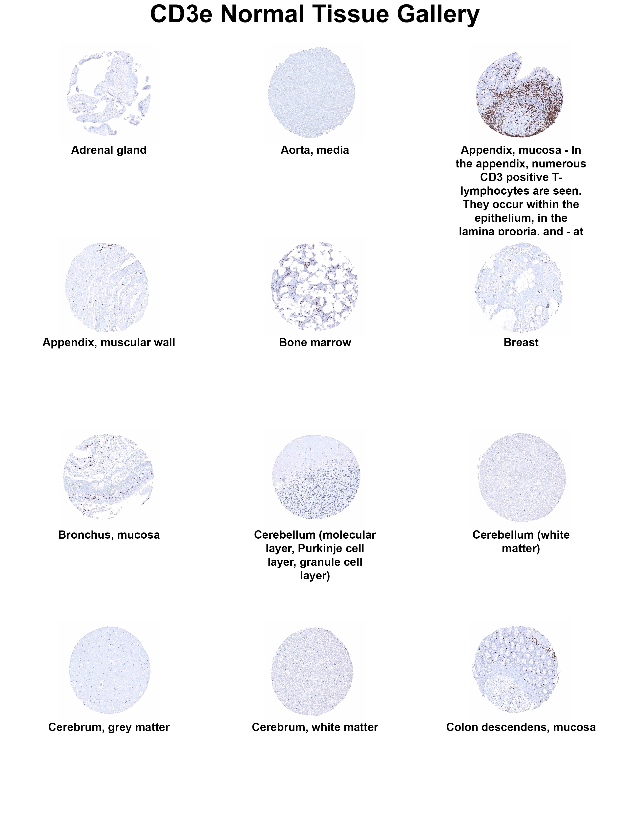 CD3 Antibody (MSVA-003R) CD3 Antibody (MSVA-003R) CD3 Normal Tissue Gallery