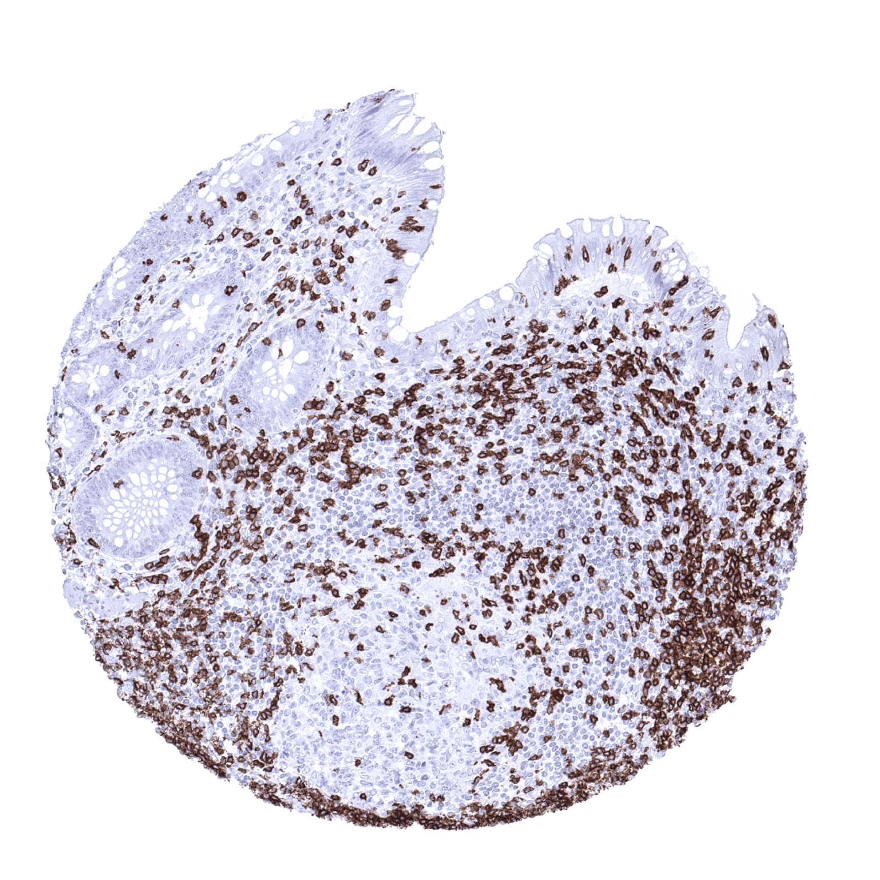 CD3 Antibody (MSVA-003R)