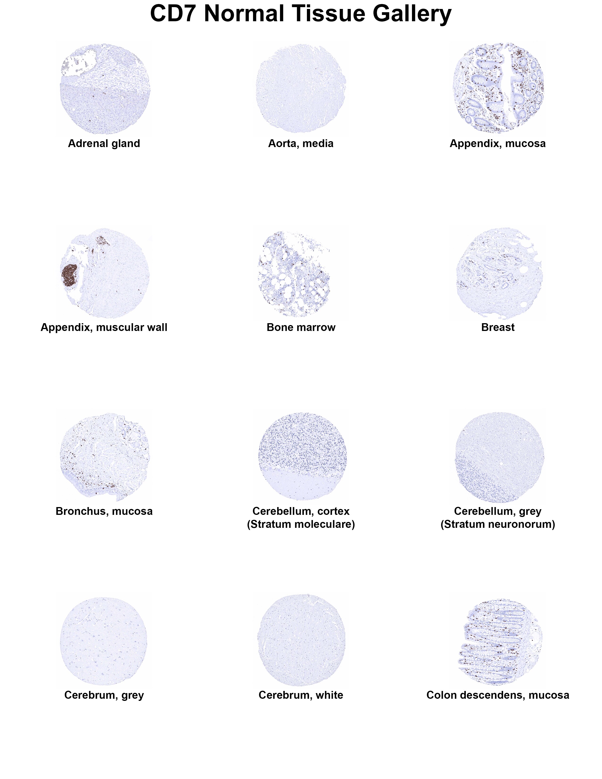 CD7 Antibody (MSVA-007R) CD7 Antibody (MSVA-007R) CD7 Normal Tissue Gallery