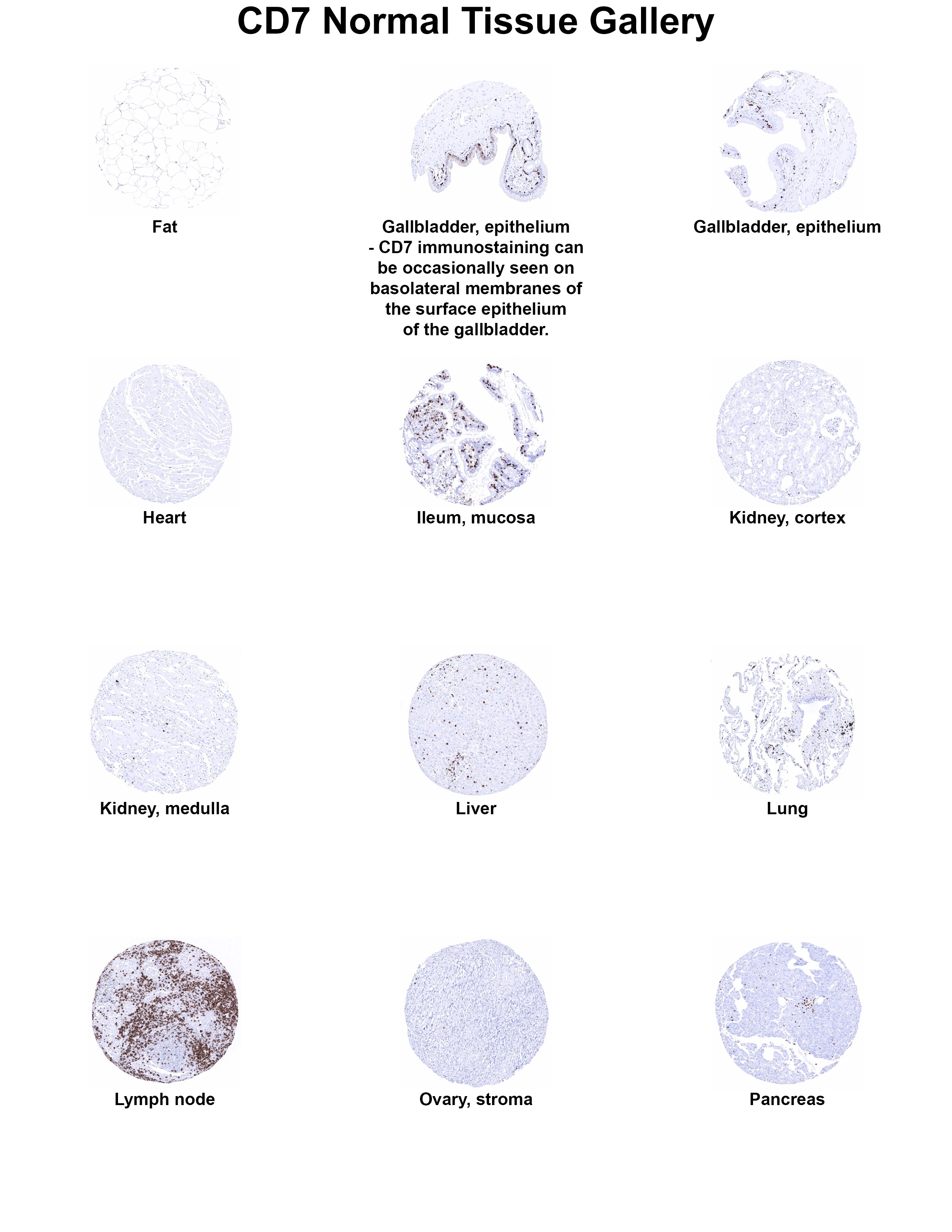 CD7 Antibody (MSVA-007R) CD7 Antibody (MSVA-007R) CD7 Normal Tissue Gallery