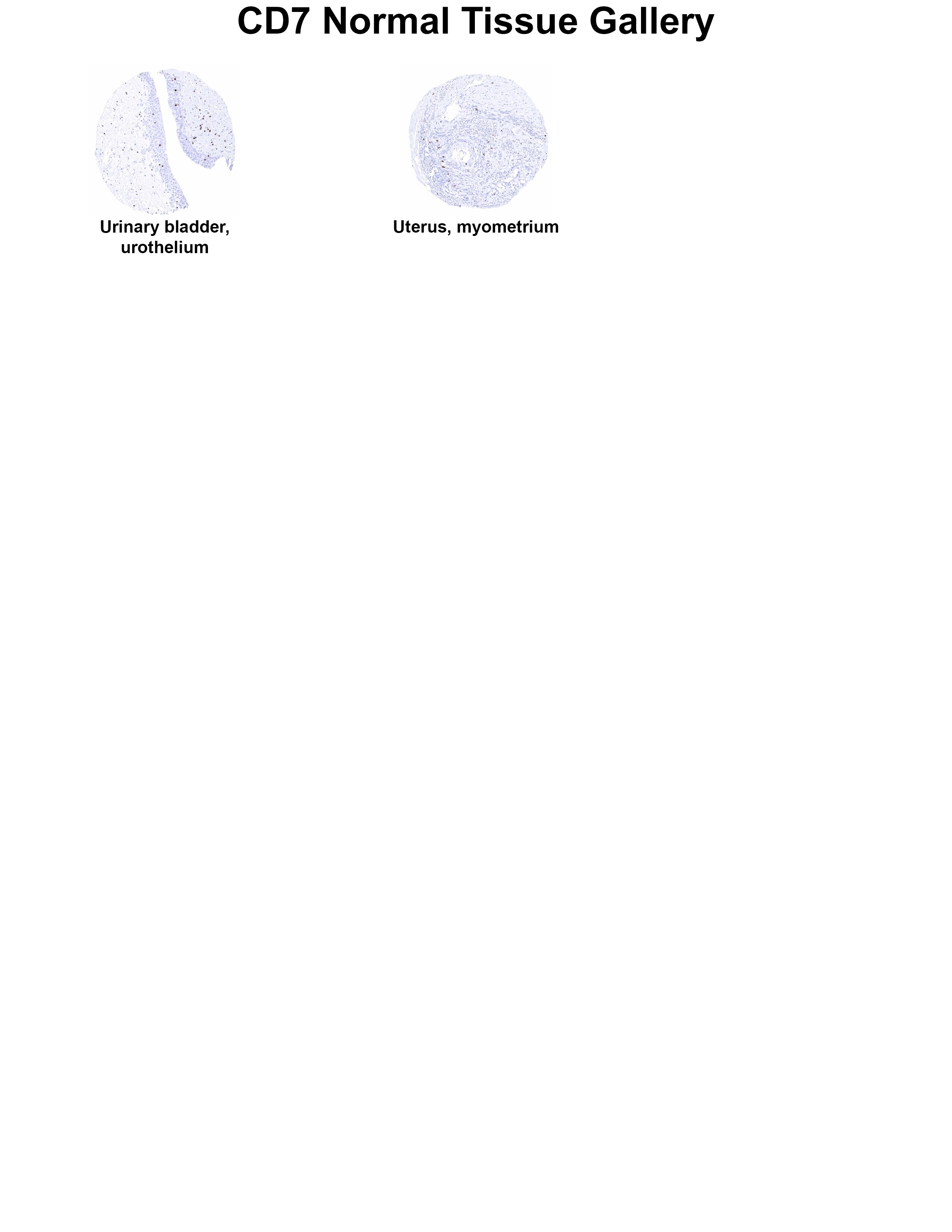 CD7 Antibody (MSVA-007R) CD7 Antibody (MSVA-007R) CD7 Normal Tissue Gallery