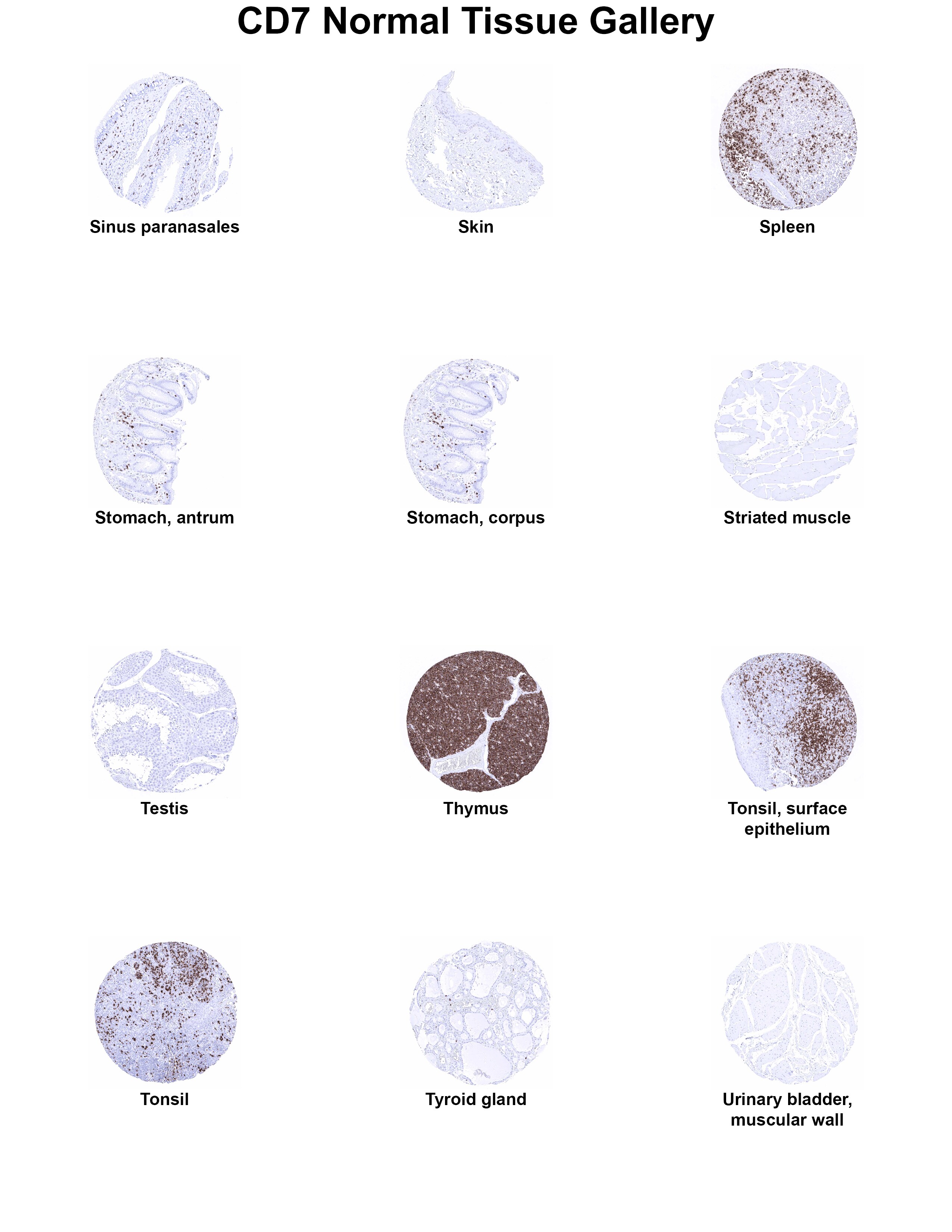 CD7 Antibody (MSVA-007R) CD7 Antibody (MSVA-007R) CD7 Normal Tissue Gallery