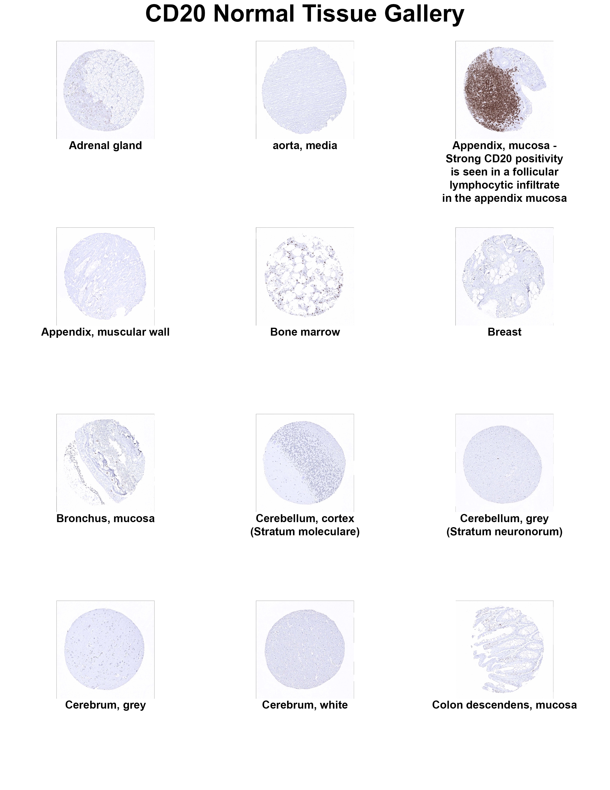 CD20 Antibody (MSVA-020R) CD20 Antibody (MSVA-020R) CD20 Normal Tissue Gallery
