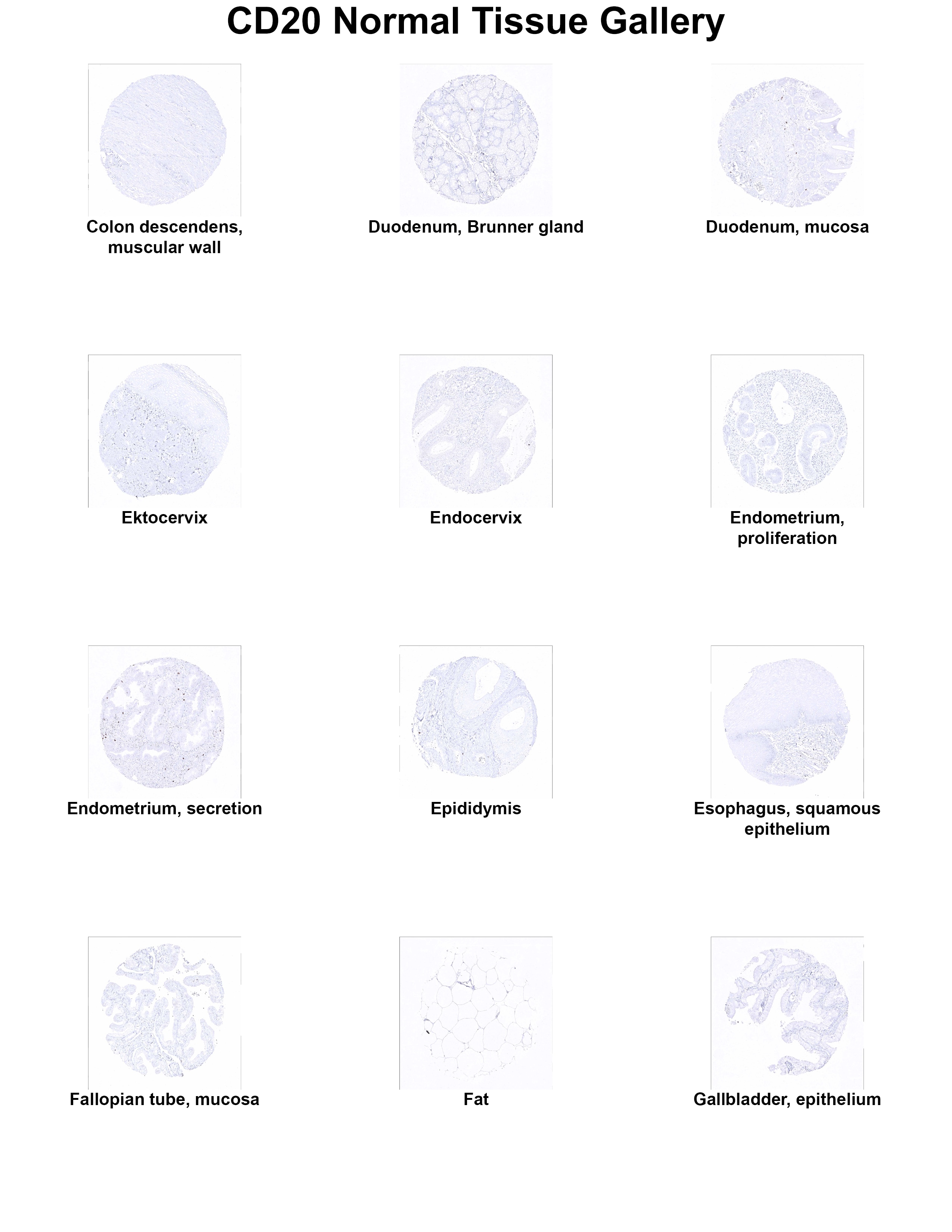 CD20 Antibody (MSVA-020R) CD20 Antibody (MSVA-020R) CD20 Normal Tissue Gallery