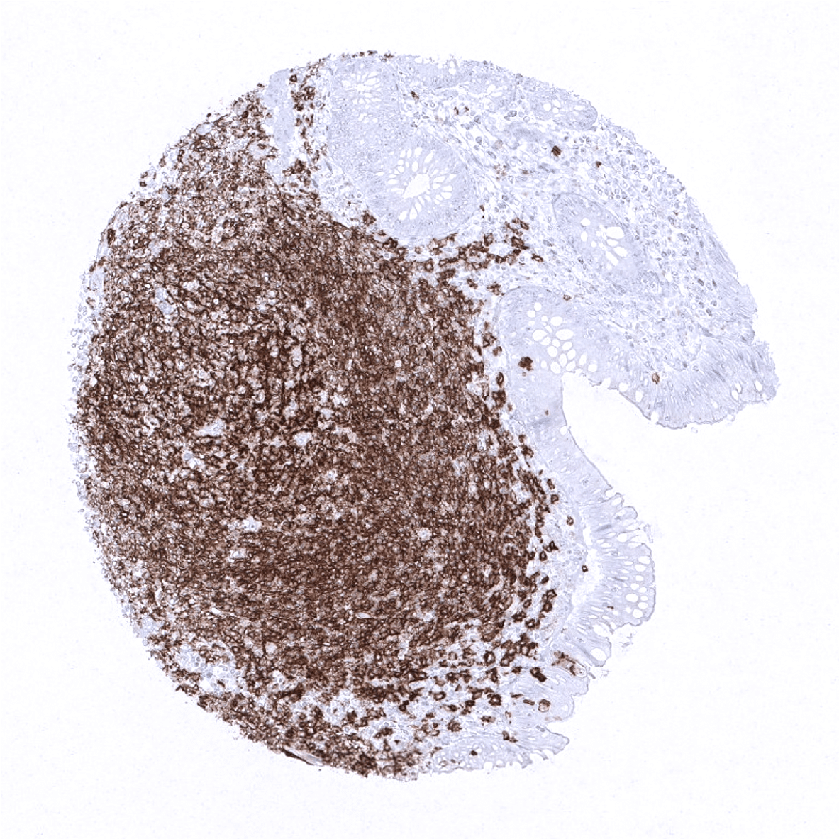 CD20 Antibody (MSVA-020R)