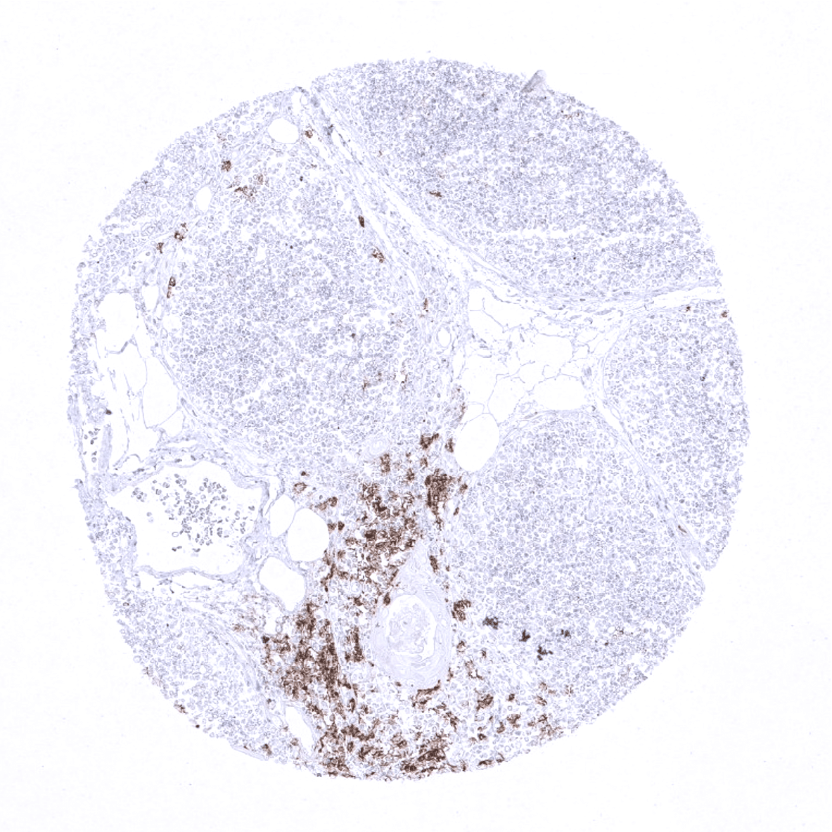 CD20 Antibody (MSVA-020R)