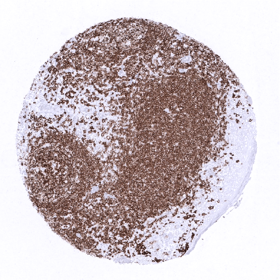 CD20 Antibody (MSVA-020R)
