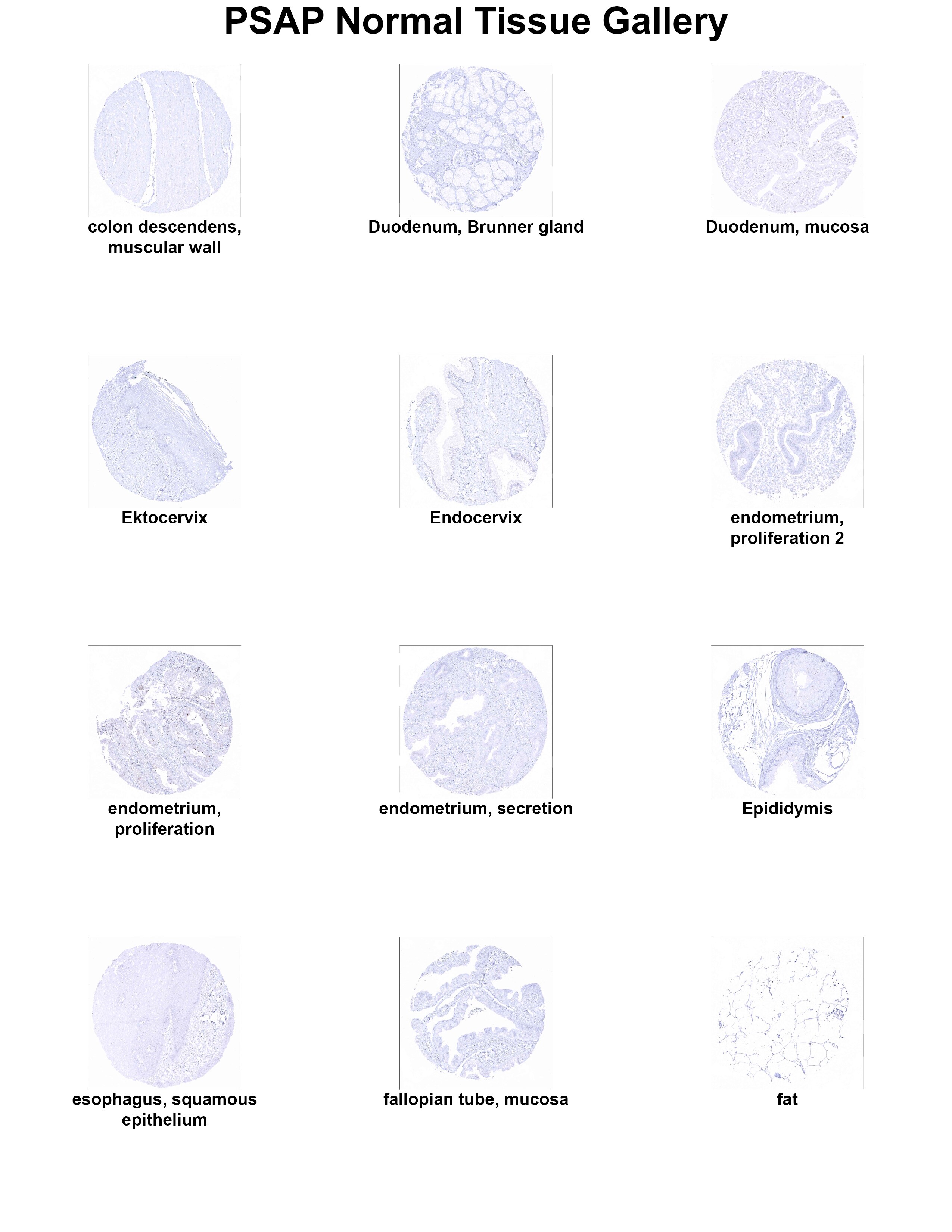 PSAP Antibody (MSVA-452M) PSAP Antibody (MSVA-452M) PSAP Normal Tissue Gallery