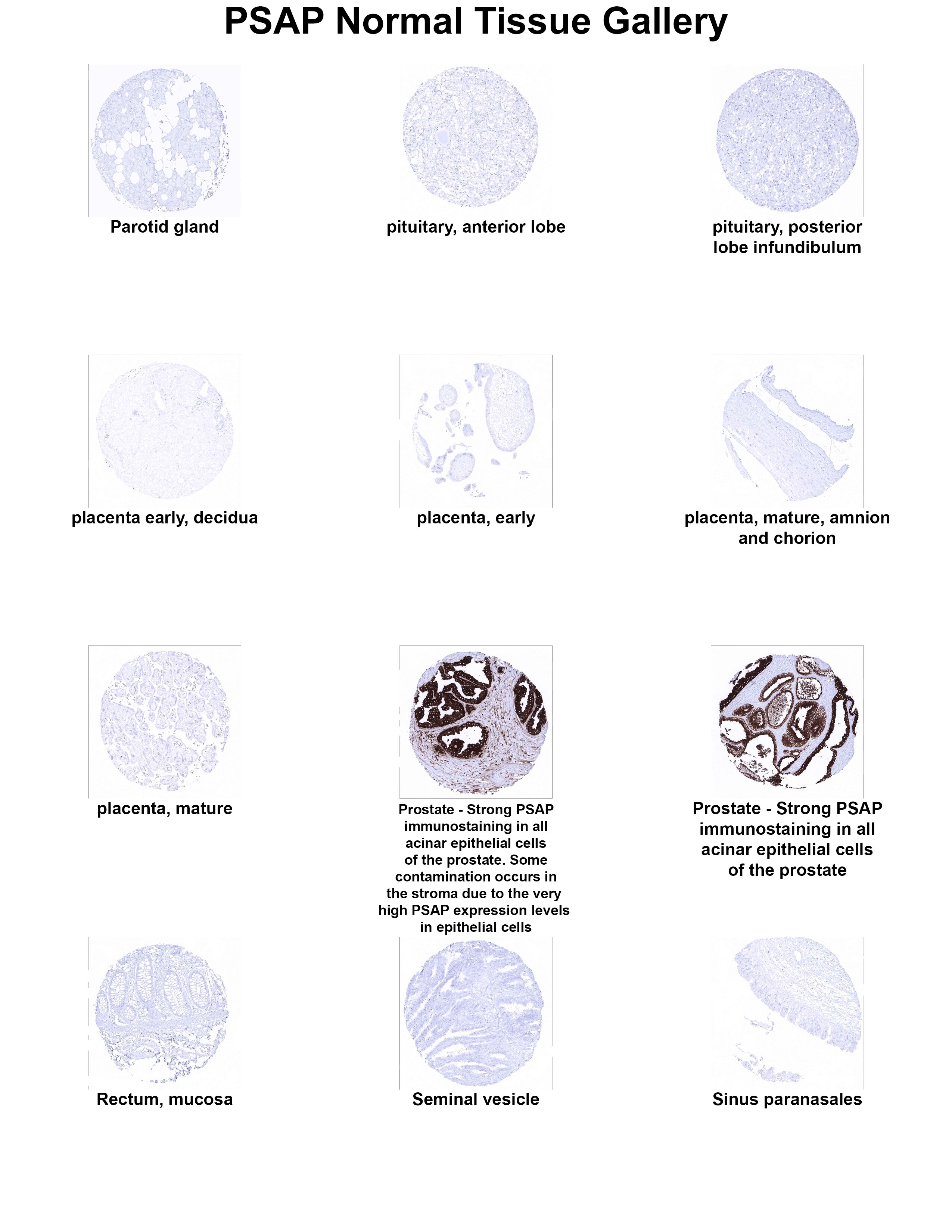 PSAP Antibody (MSVA-452M) PSAP Antibody (MSVA-452M) PSAP Normal Tissue Gallery