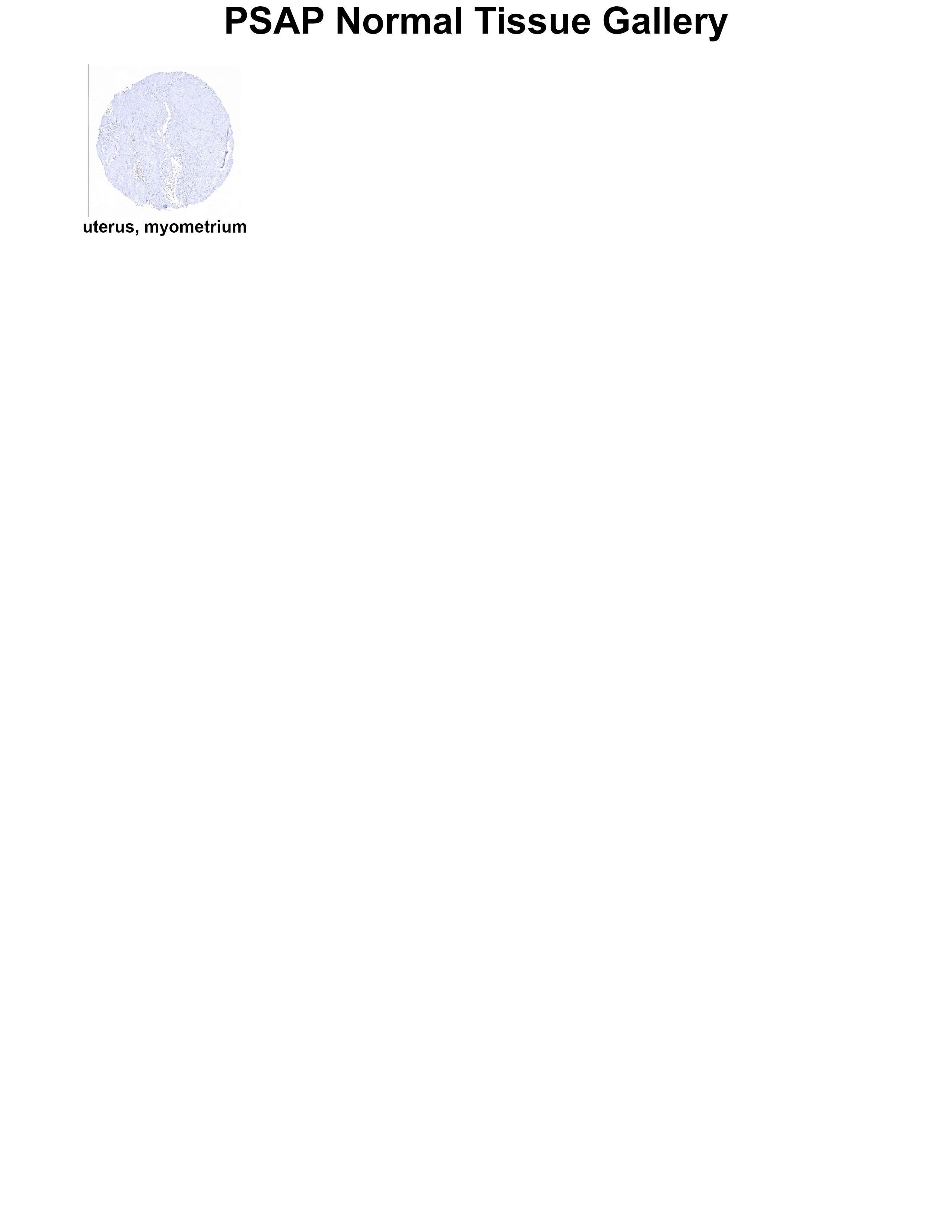 PSAP Antibody (MSVA-452M) PSAP Antibody (MSVA-452M) PSAP Normal Tissue Gallery