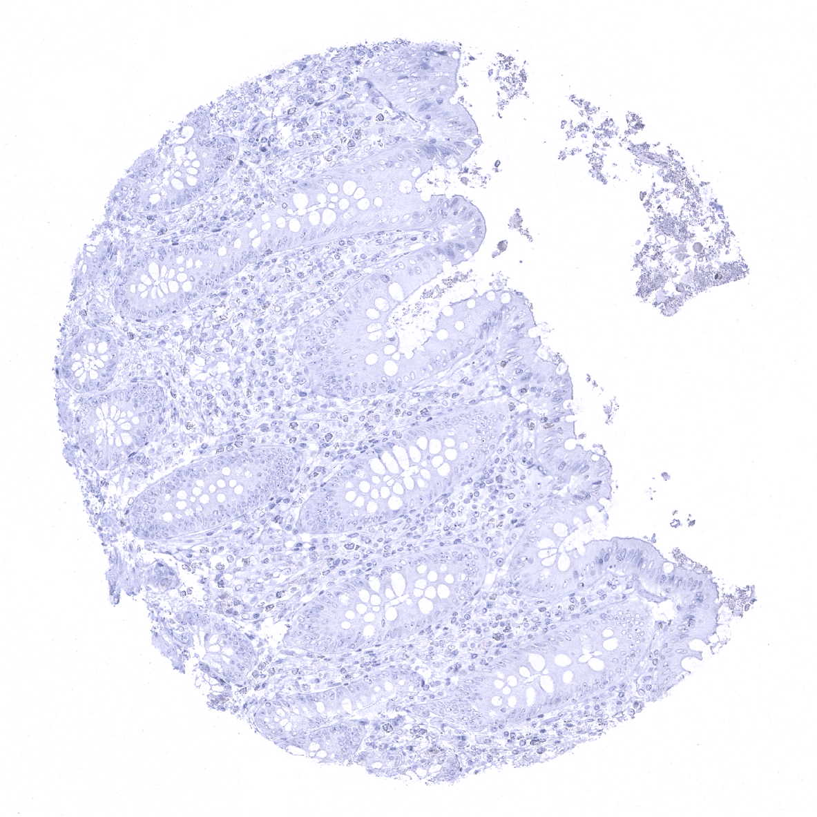 PSAP Antibody (MSVA-452M)