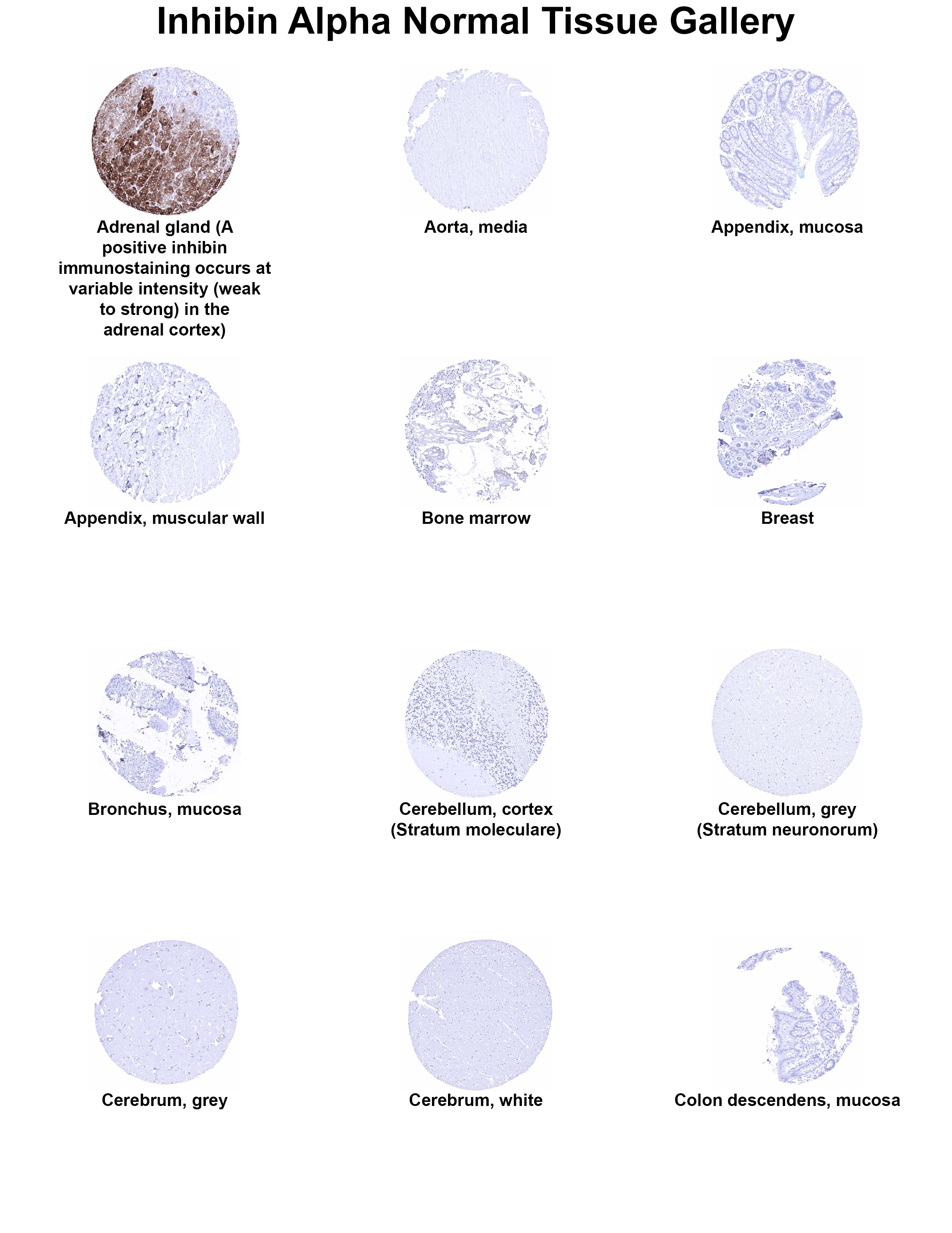Inhibin alpha Antibody (MSVA-561R) Inhibin alpha Antibody (MSVA-561R) Inhibin alpha Normal Tissue Gallery