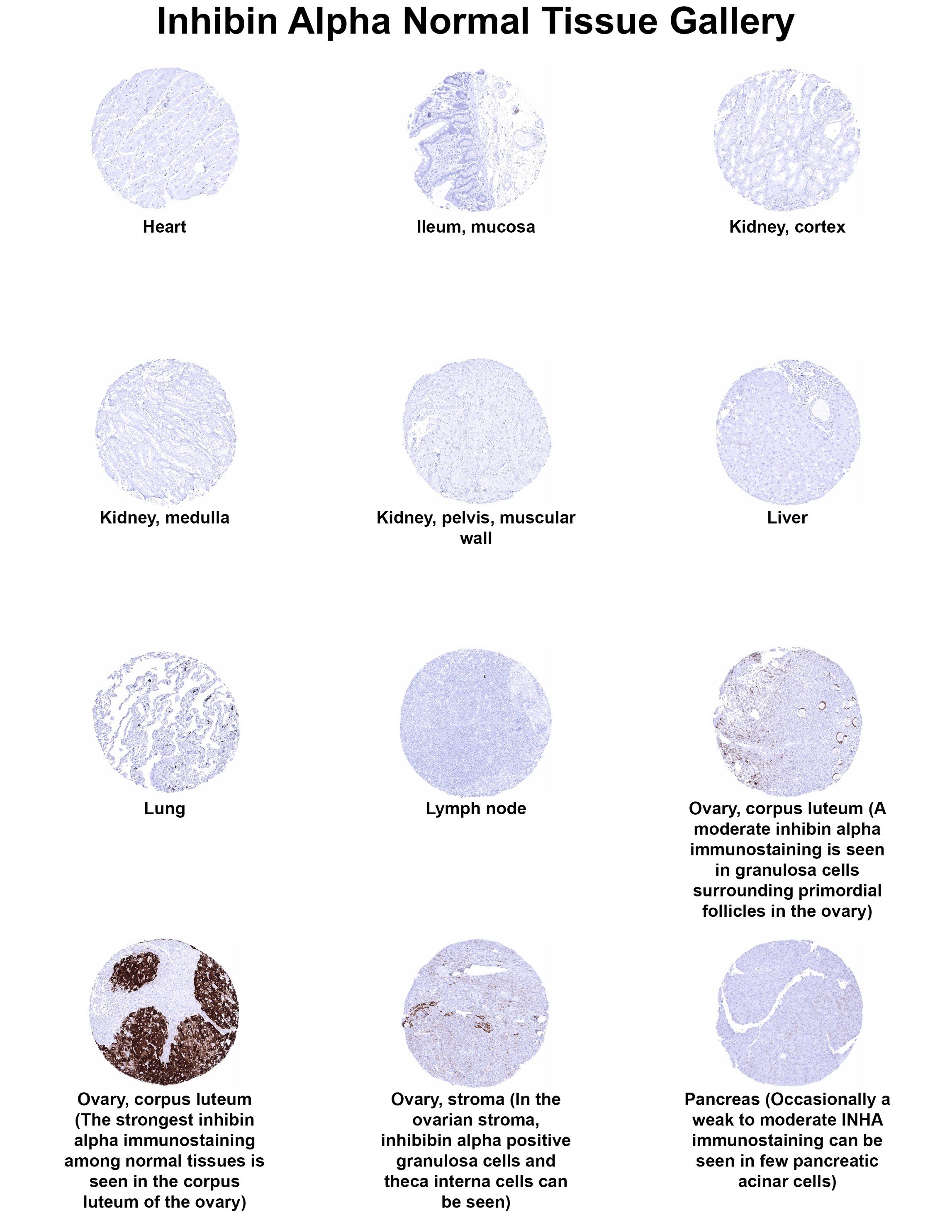 Inhibin alpha Antibody (MSVA-561R) Inhibin alpha Antibody (MSVA-561R) Inhibin alpha Normal Tissue Gallery
