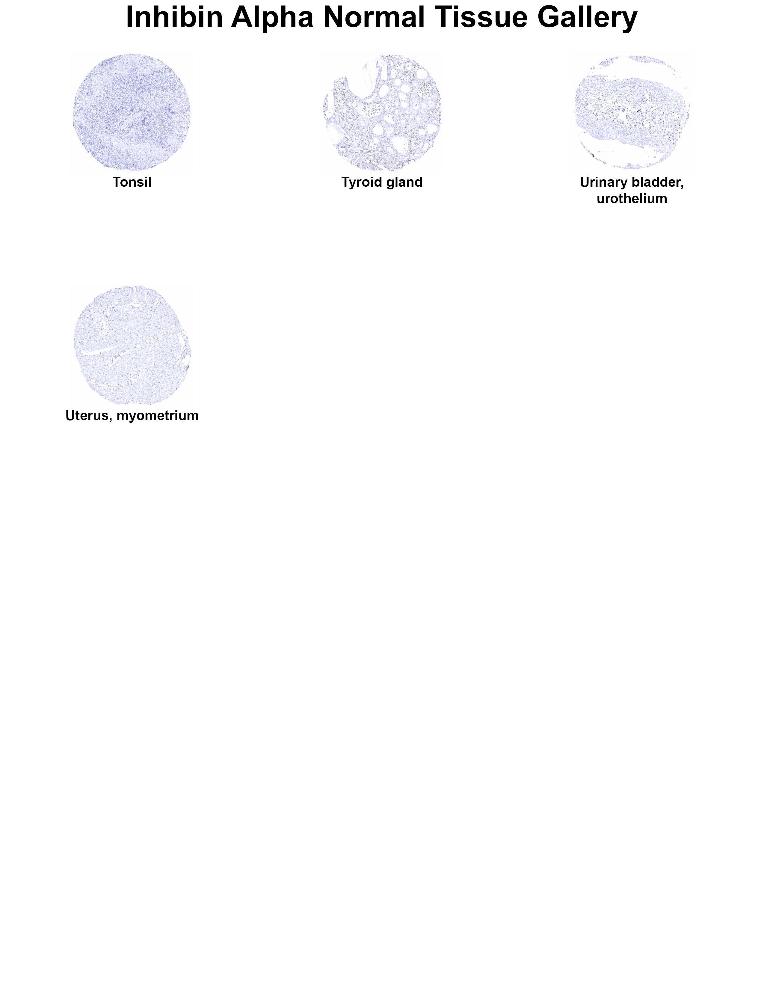 Inhibin alpha Antibody (MSVA-561R) Inhibin alpha Antibody (MSVA-561R) Inhibin alpha Normal Tissue Gallery