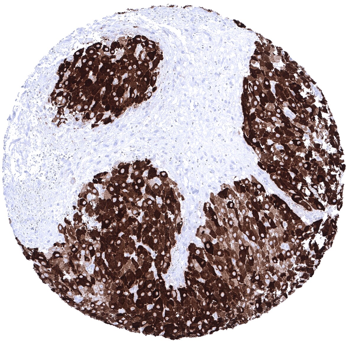 Inhibin alpha Antibody (MSVA-561R)