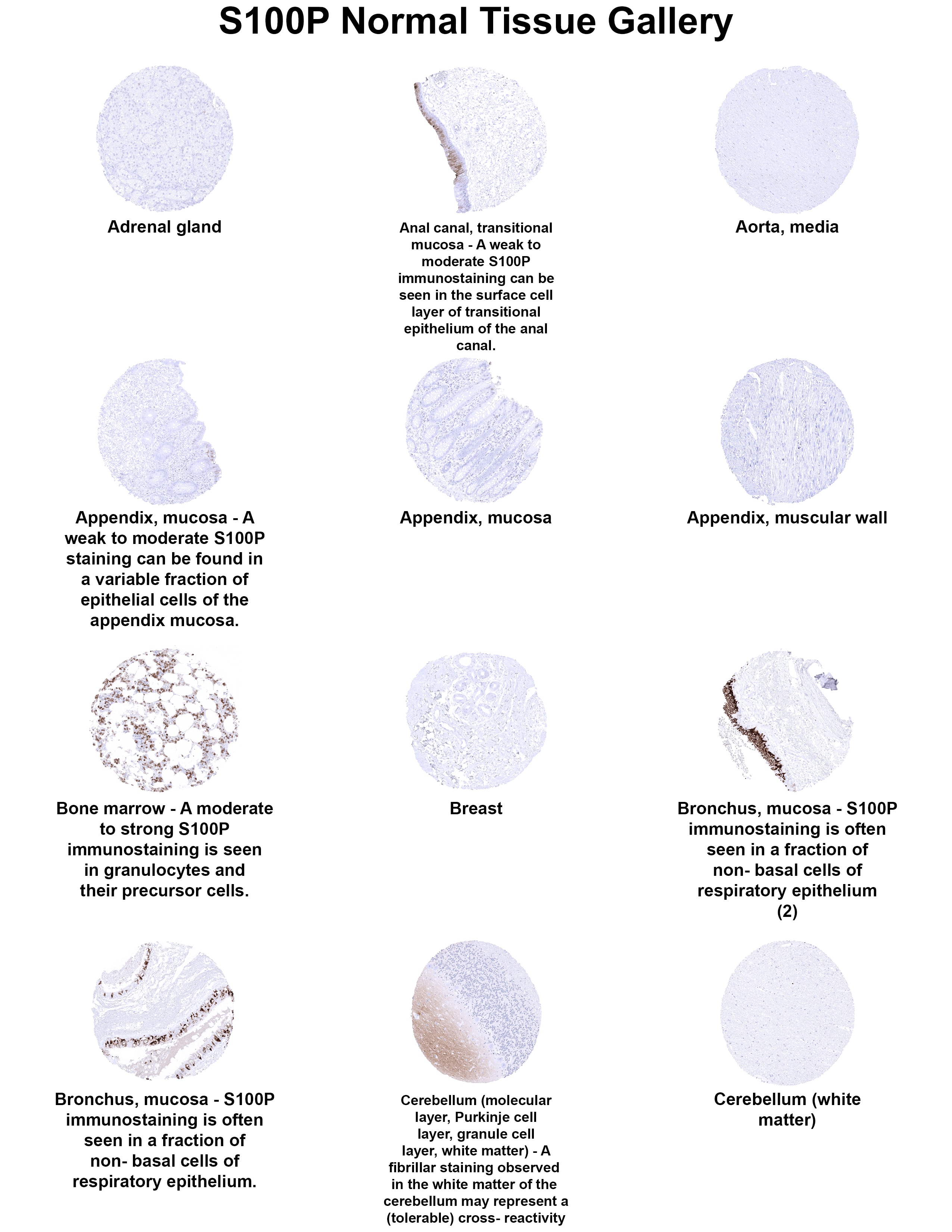 S100P Antibody (MSVA-480R) S100P Antibody (MSVA-480R) S100P Normal Tissue Gallery