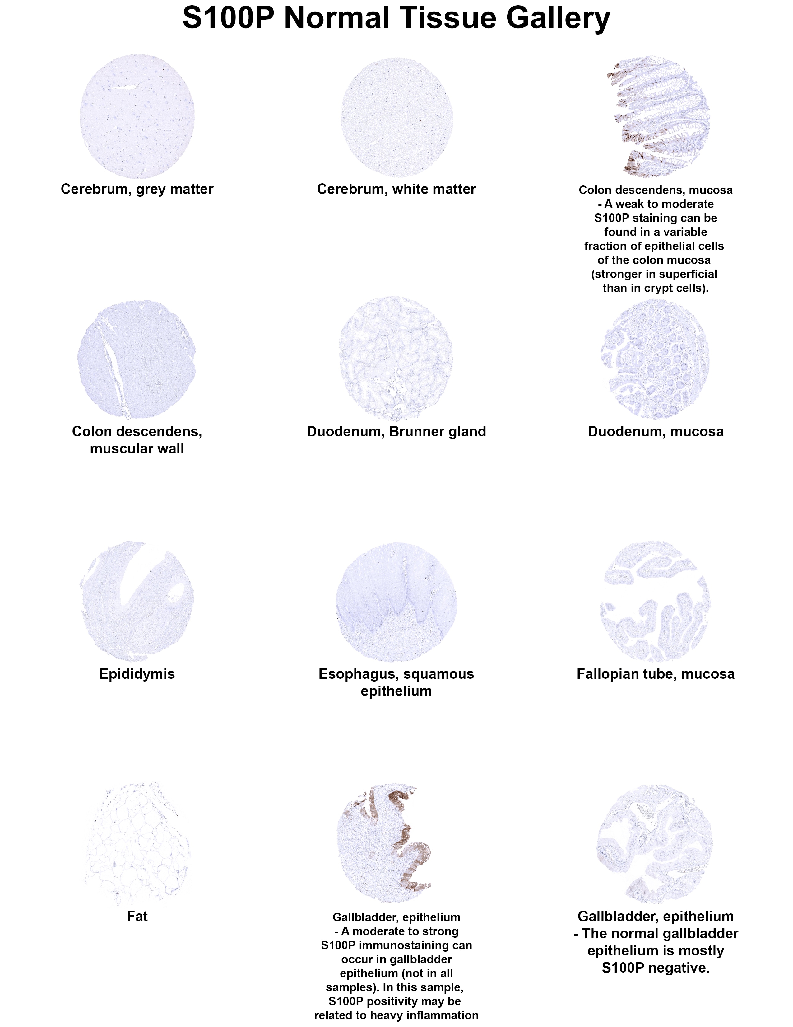 S100P Antibody (MSVA-480R) S100P Antibody (MSVA-480R) S100P Normal Tissue Gallery