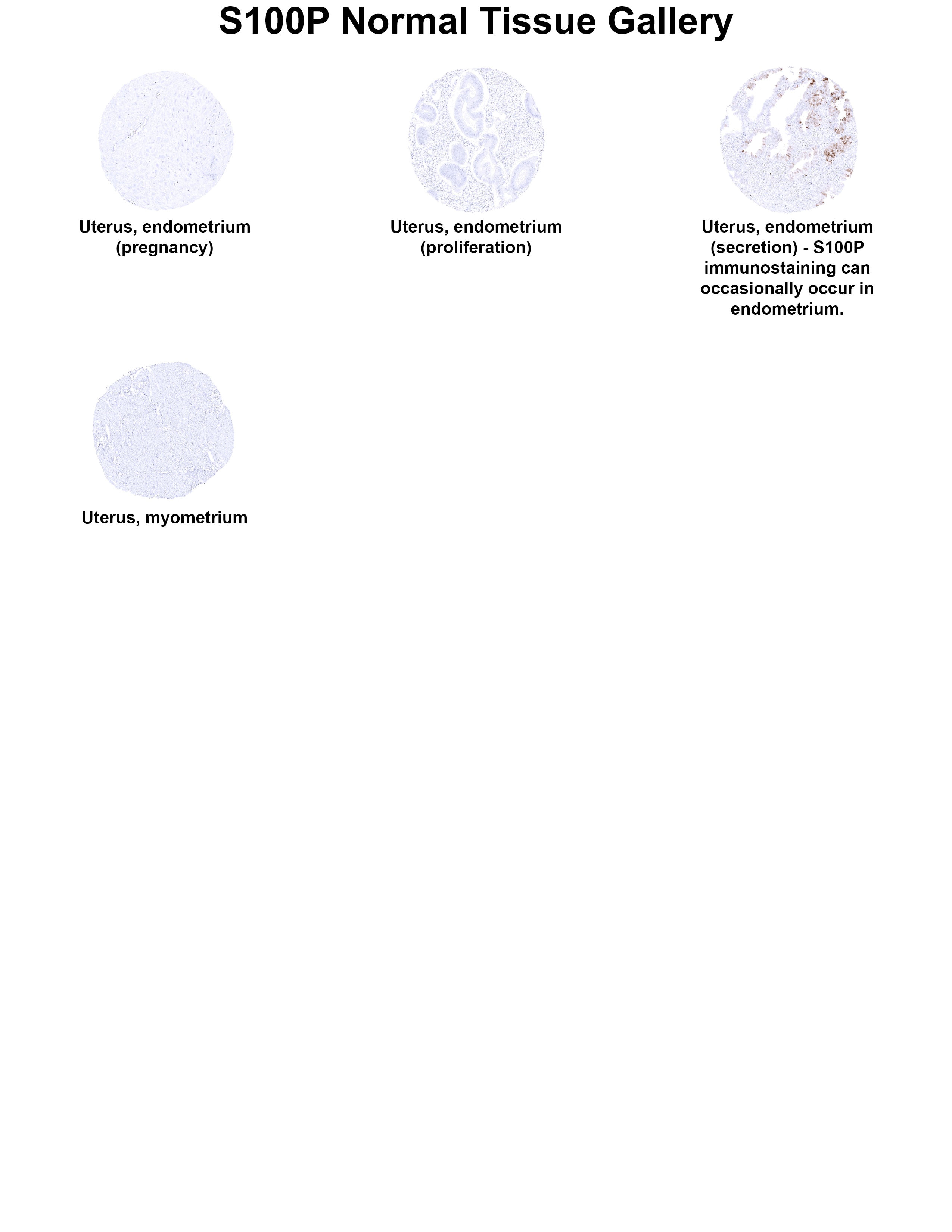 S100P Antibody (MSVA-480R) S100P Antibody (MSVA-480R) S100P Normal Tissue Gallery