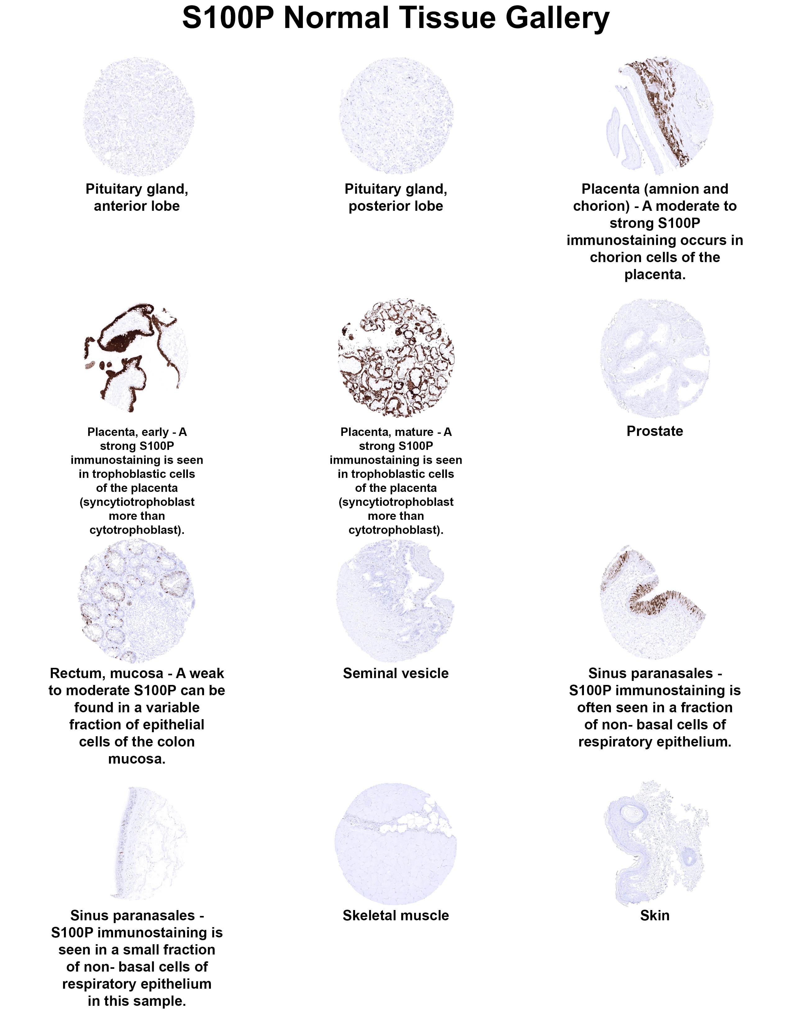 S100P Antibody (MSVA-480R) S100P Antibody (MSVA-480R) S100P Normal Tissue Gallery