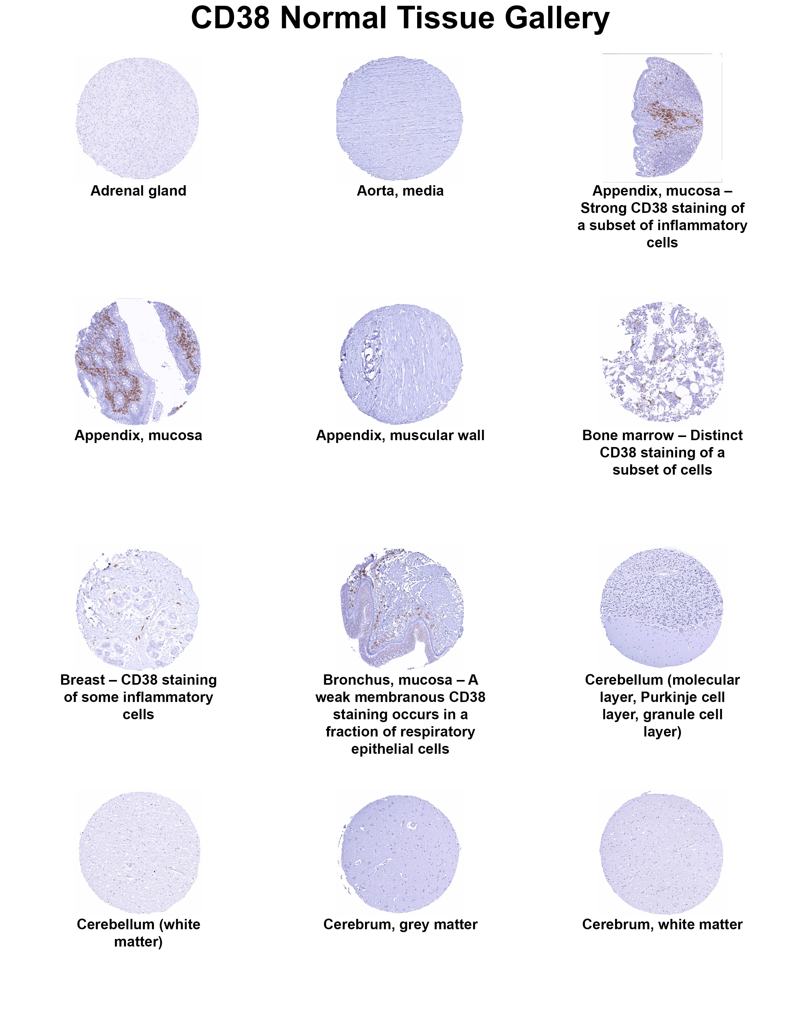 CD38 Antibody (MSVA-038R) CD38 Antibody (MSVA-038R) CD38 Normal Tissue Gallery